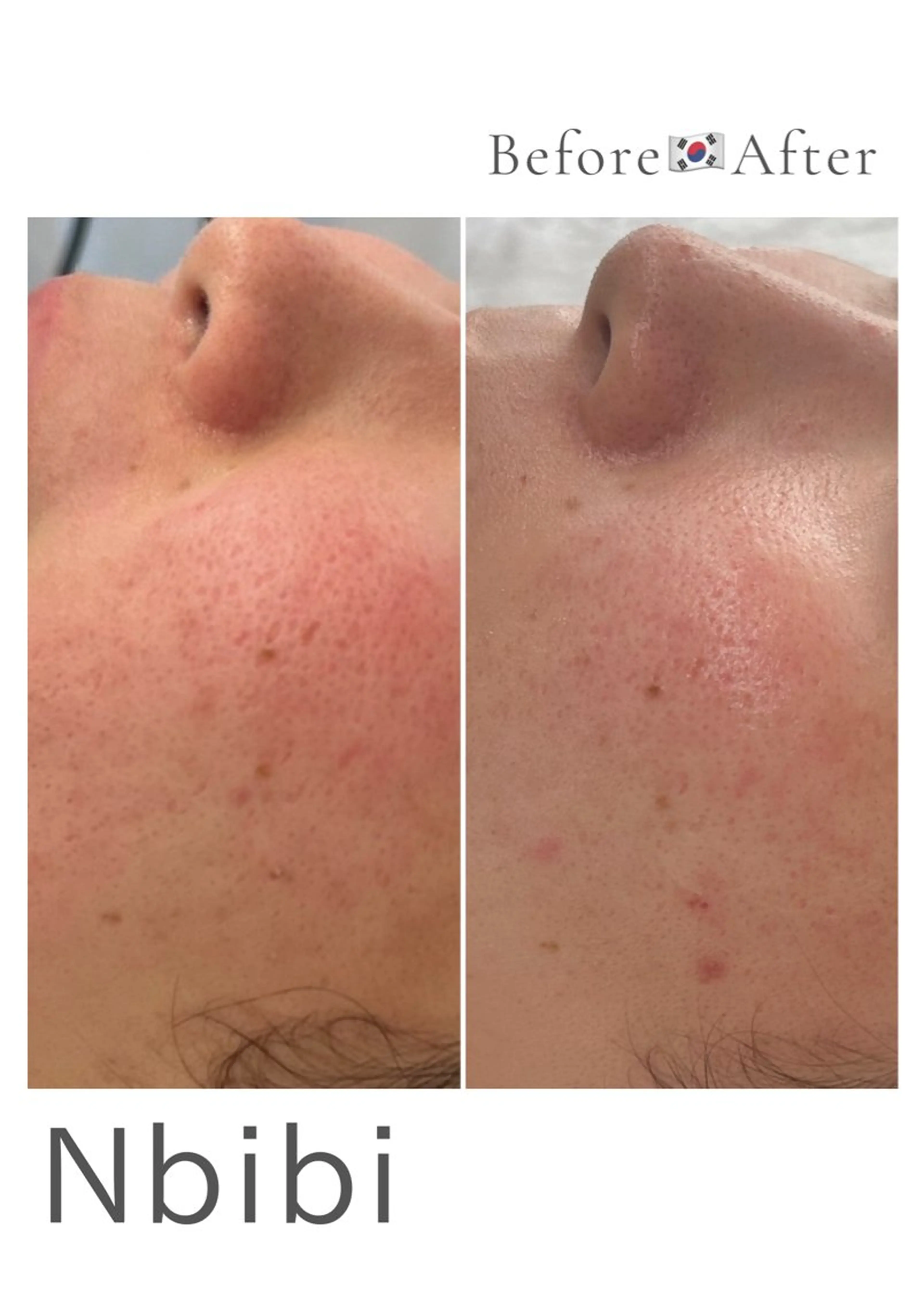 エステ 韓国🇰🇷価格 サロン_Nbibiのエステ・リラクイメージ