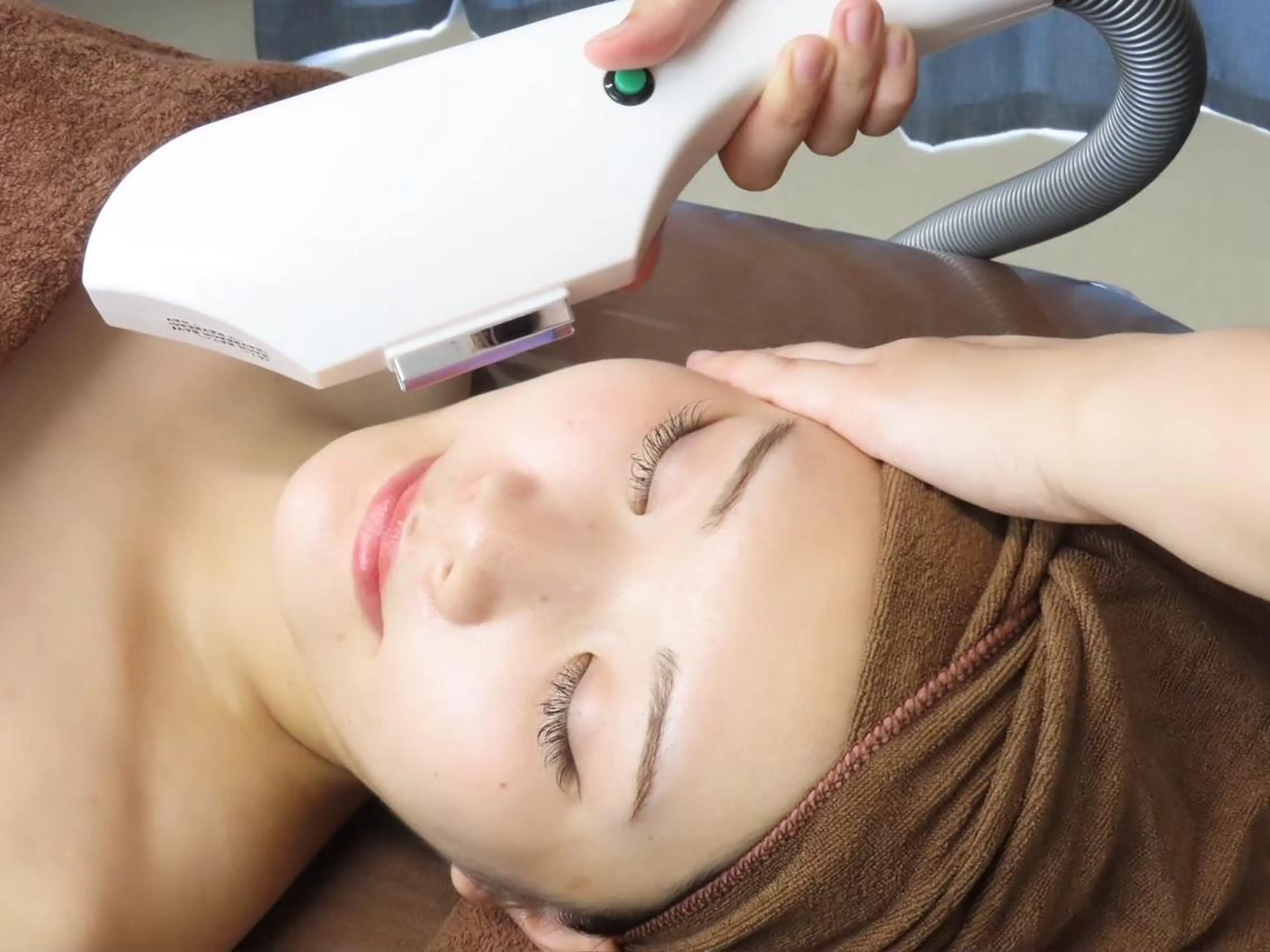 【minimo限定】美肌顔脱毛✨4,980円→2,500円⭐️メンズのヒゲ脱毛もOK🥸の写真