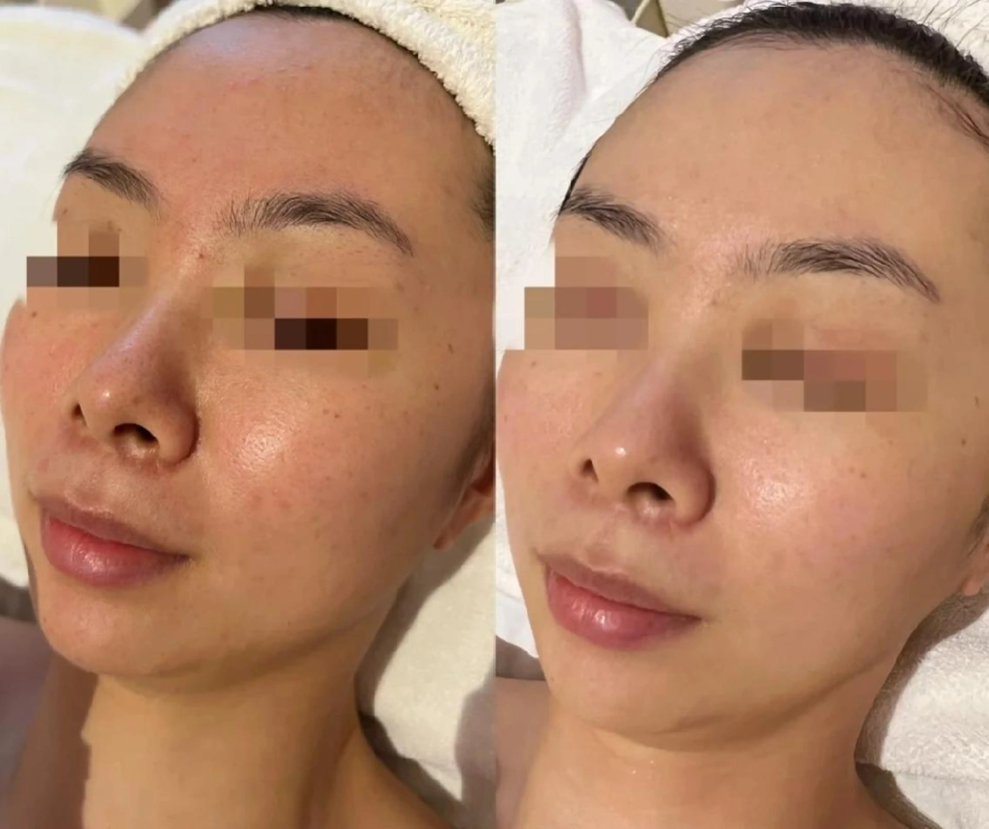 エステ aliaハイフ&水光ジェットサロン所属・aliaハーブ水光店 エステティシャン募集のエステ・リラクイメージ