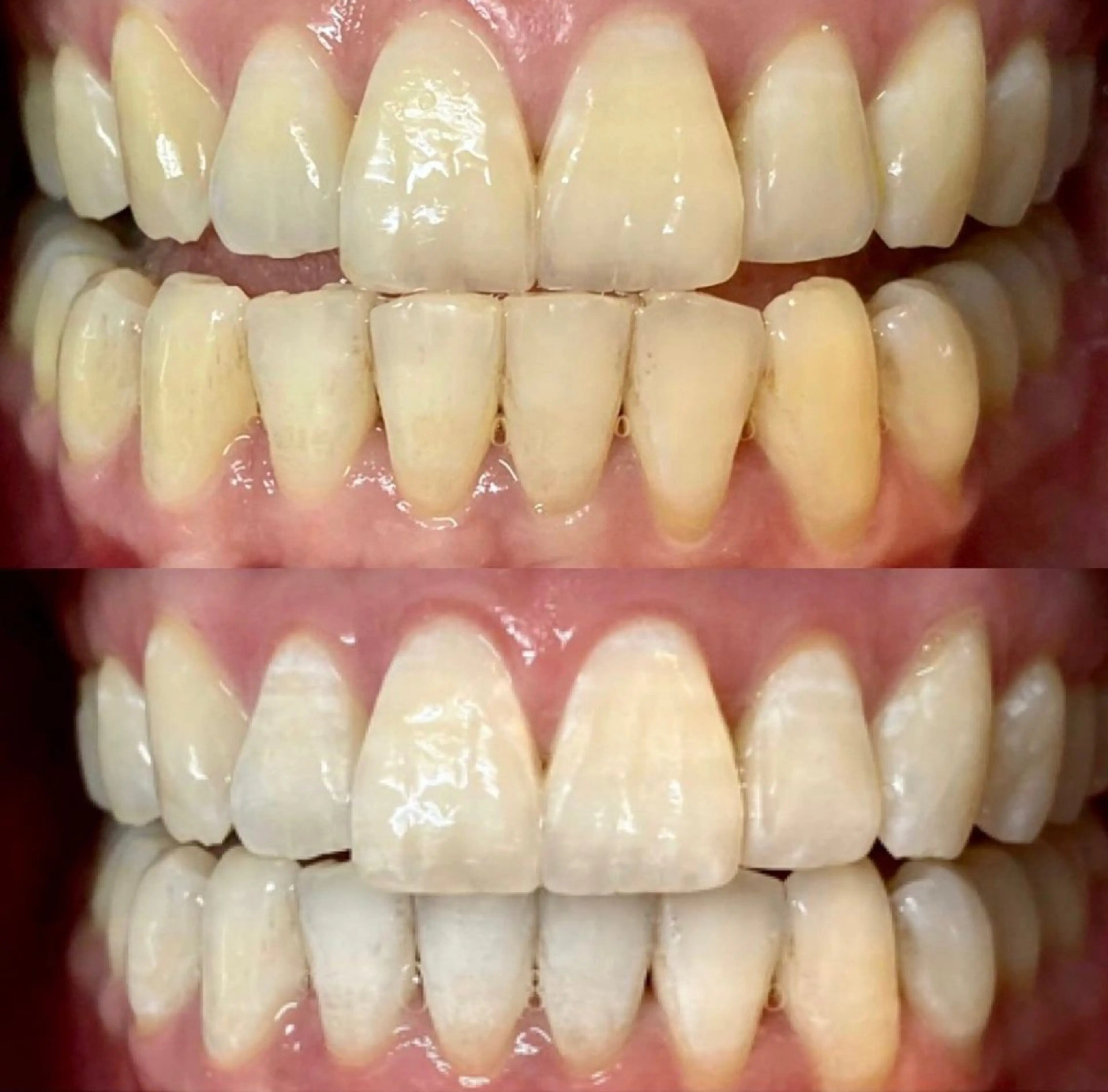 エステ リラク LBSホワイトニング上野店所属・LBSホワイトニング 🌐 上野店公式のエステ・リラクイメージ