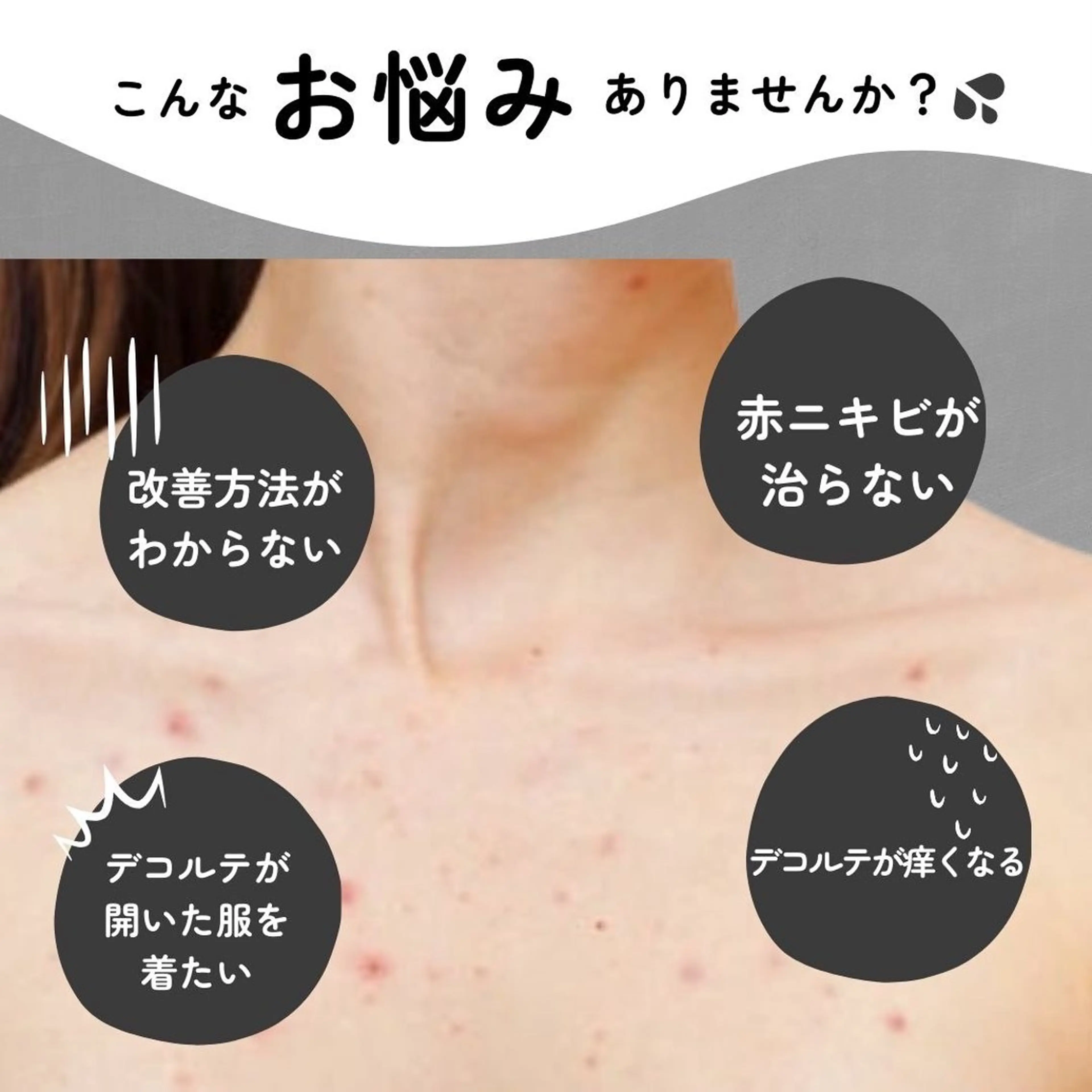 Meupニキビ専門店 背中/ハーブ/肌管理のその他イメージ