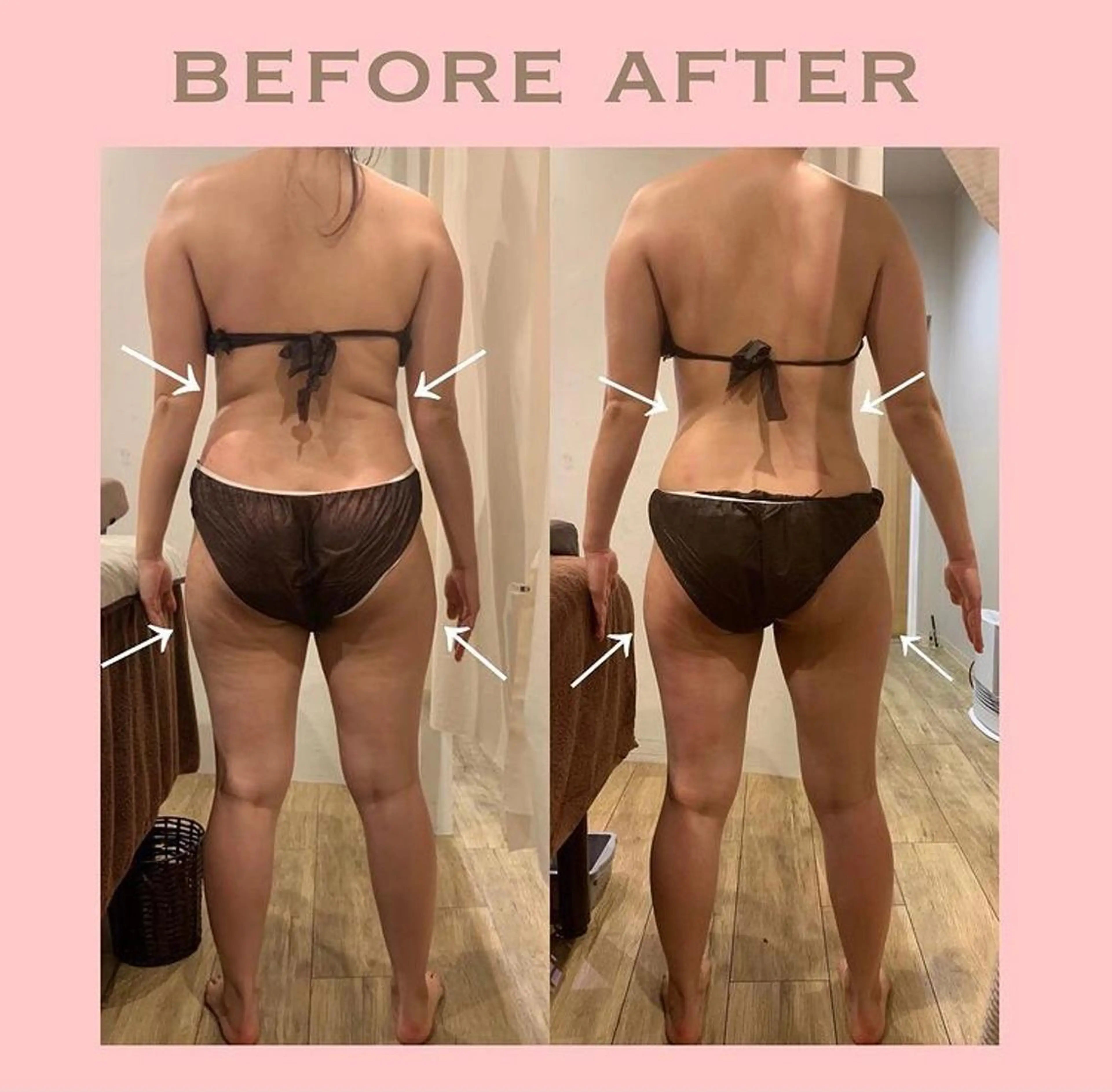 エステ le  bourgeon所属・le bourgeonのエステ・リラクイメージ