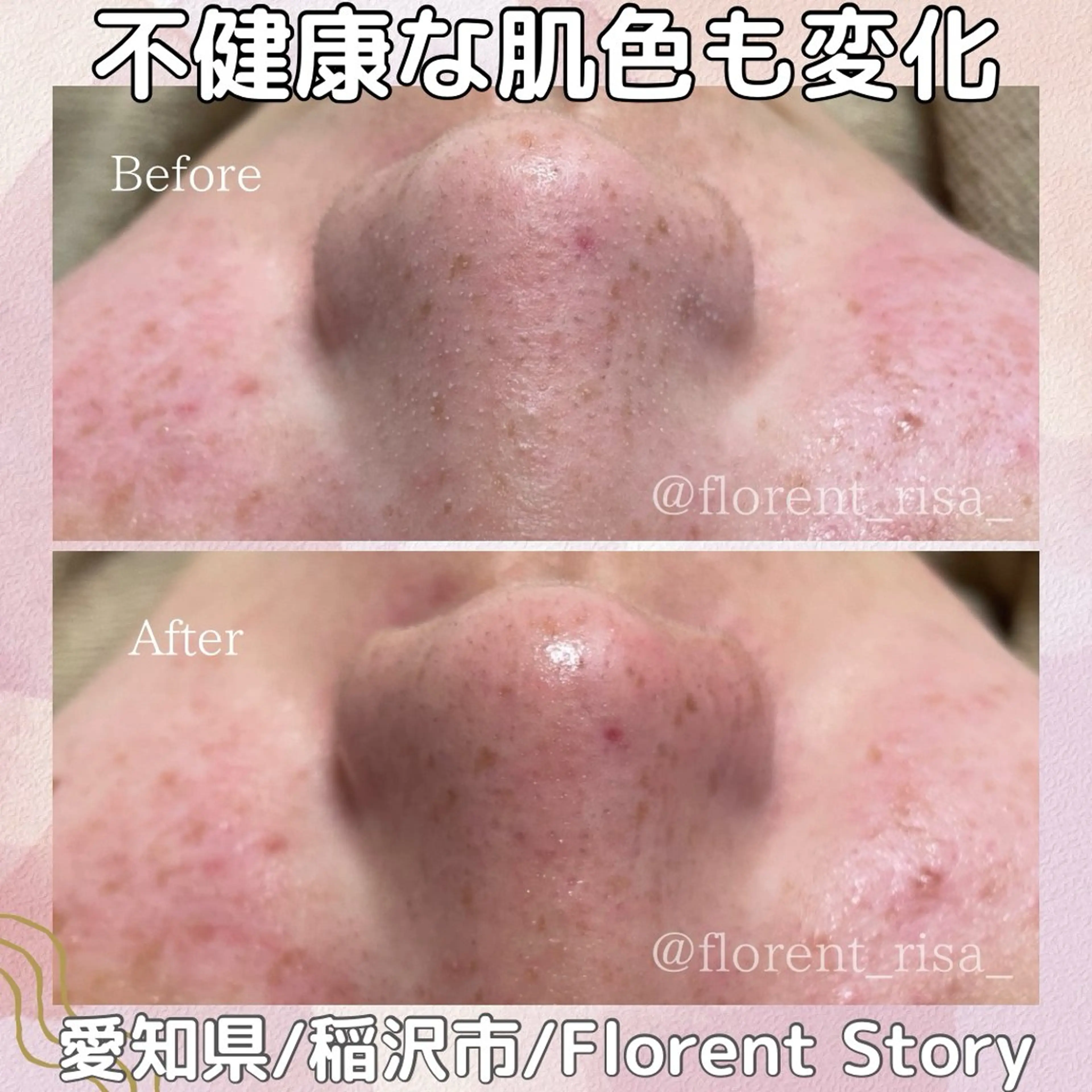 エステ 田中 里沙のエステ・リラクイメージ