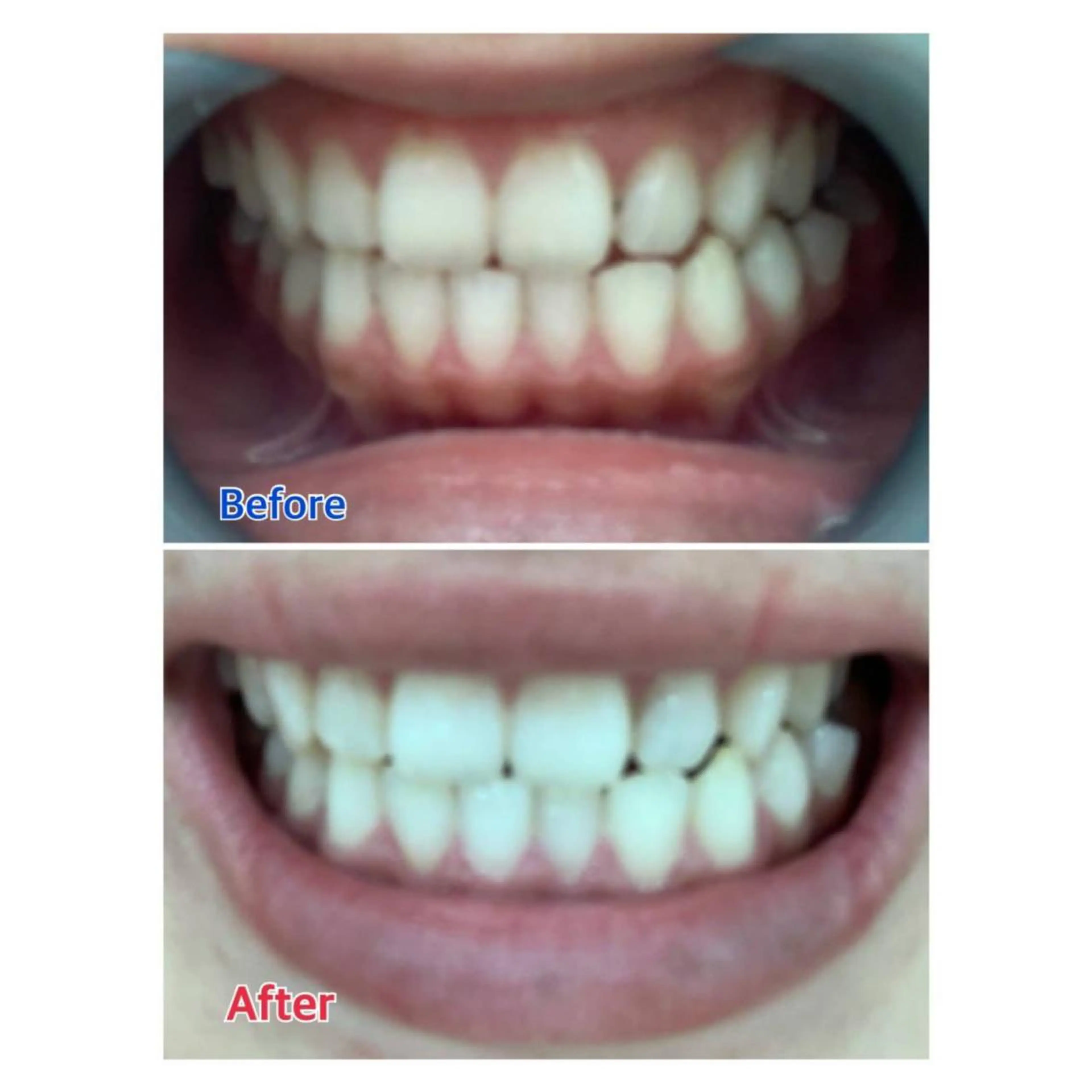 MBEAUTYSALON 千葉店・京成大久保所属・Melty 輝のその他イメージ