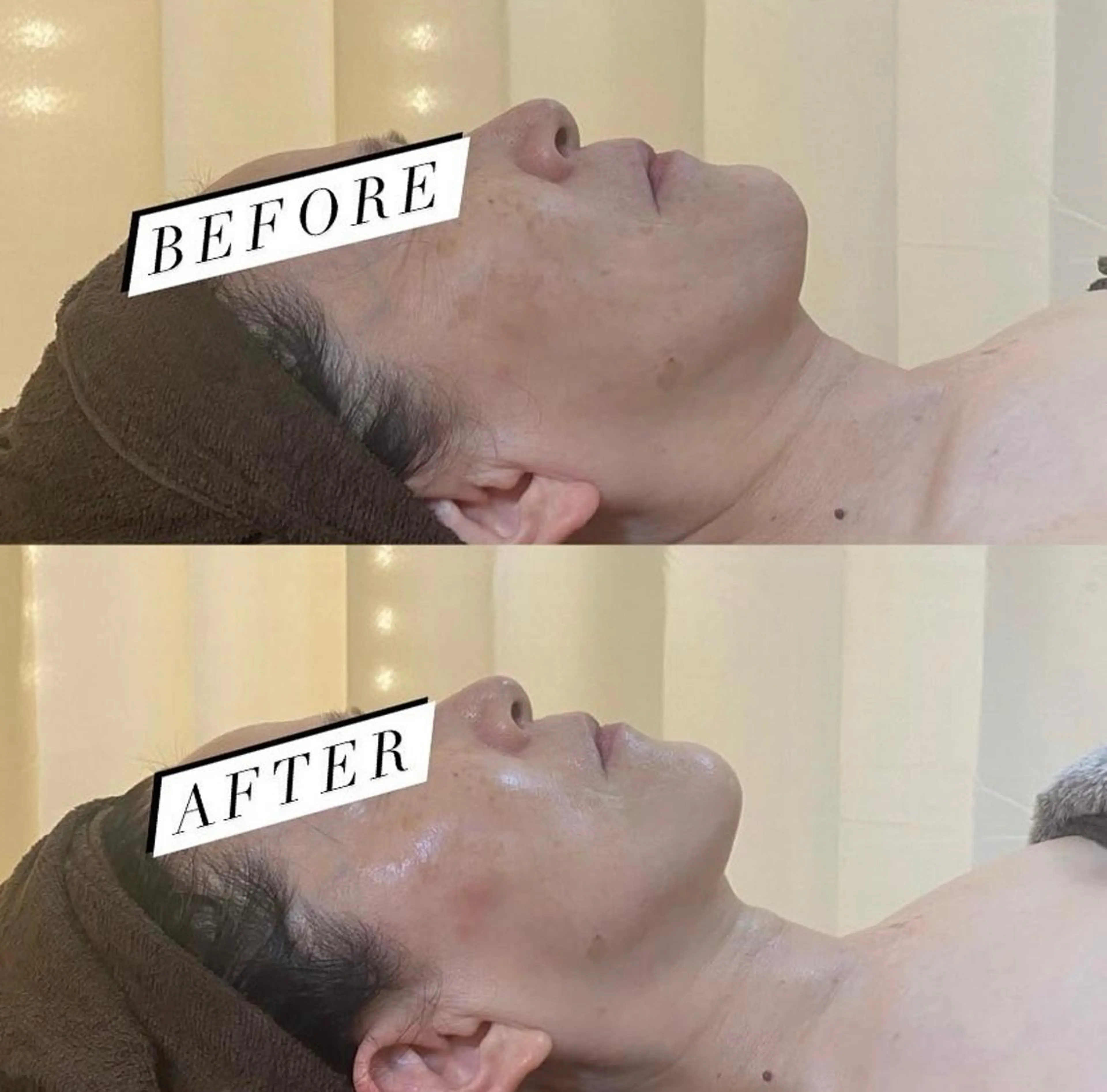 BELCIA福岡店　récolte de BELCIA（レコルトデベルシア）所属・BELCIA福岡店 レコルトデベルシアのエステ・リラクイメージ