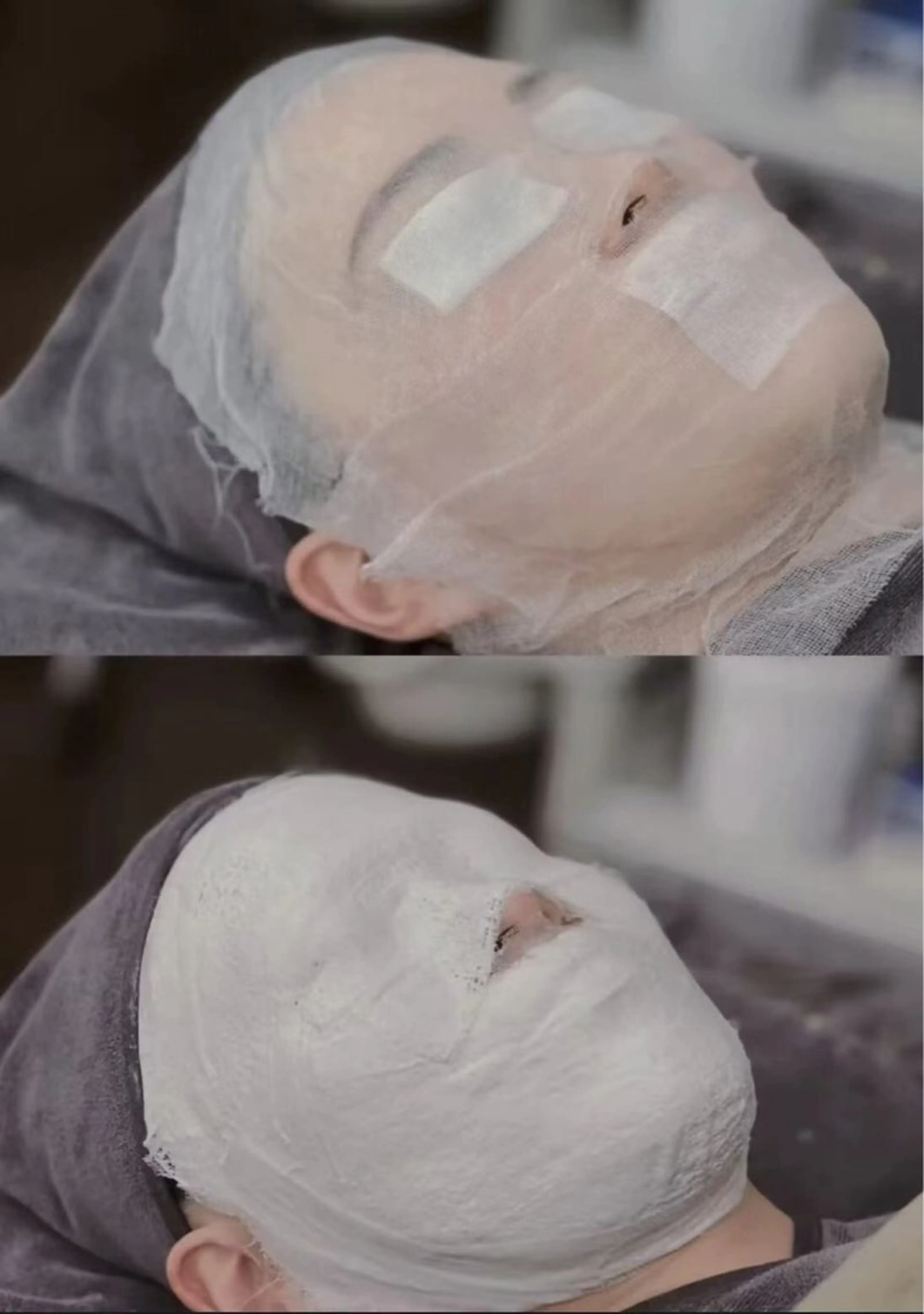 超小顔造顔コルギ+高級石膏パック60の写真