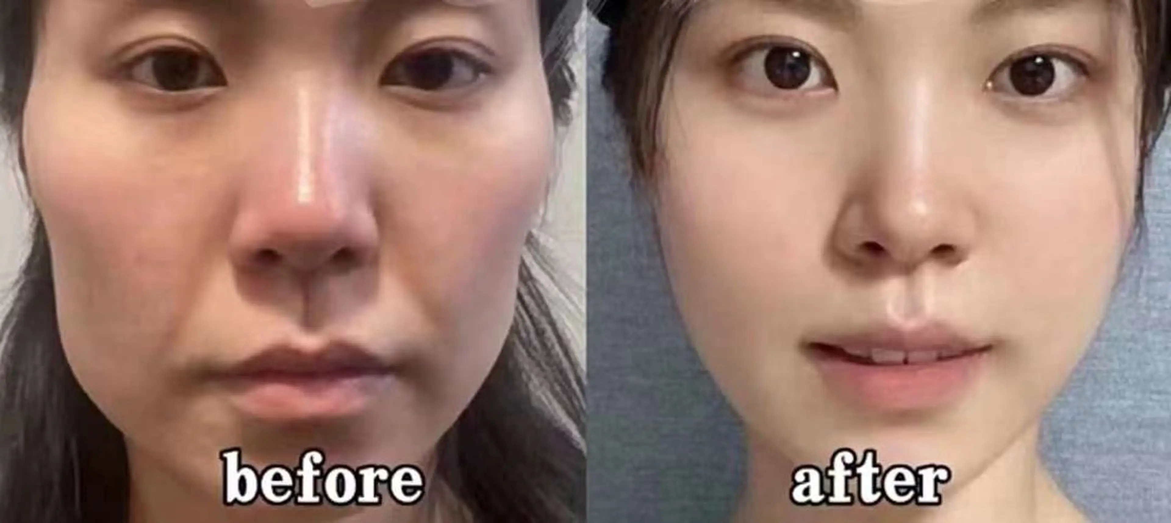 マツエク・マツパ 結婚式・ブライダル エステ aliaハイフ&水光ジェットサロン所属・aliaハーブ水光店 エステティシャン募集のエステ・リラクイメージ