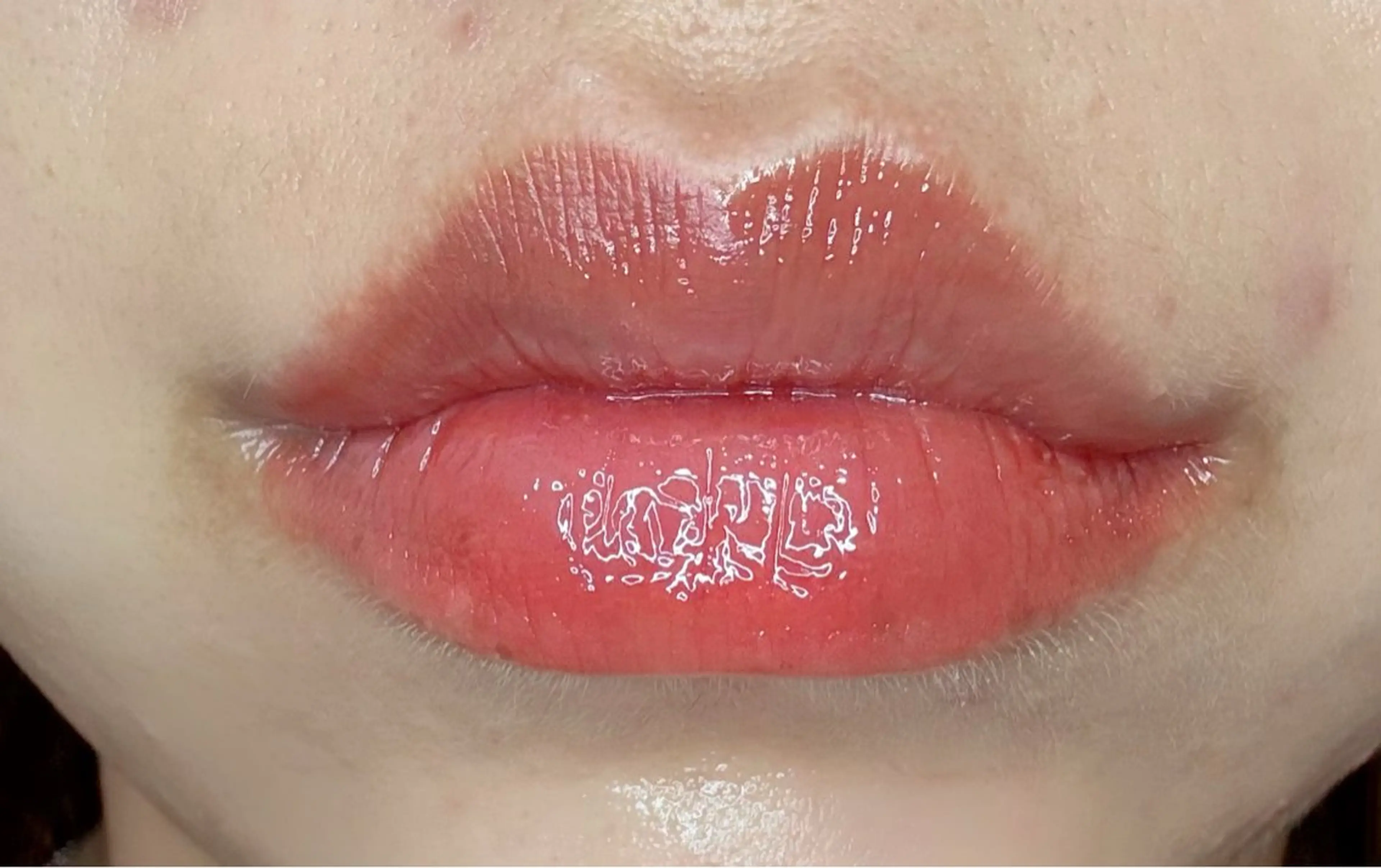 EstheticSalonReTweet所属・竹谷 春希のエステ・リラクイメージ