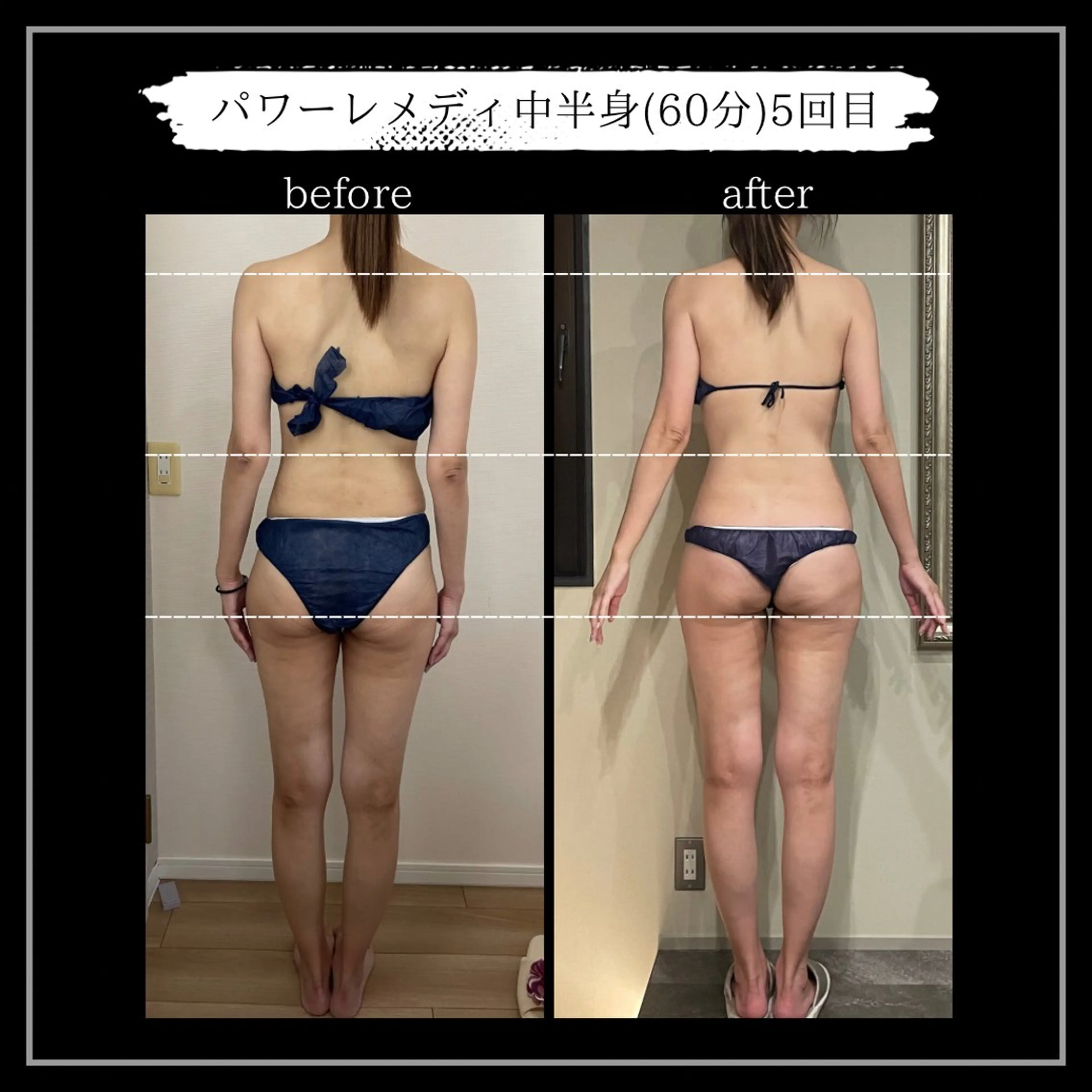 オフ:オン所属・オフ:オン 全身筋膜マッサージのエステ・リラクイメージ