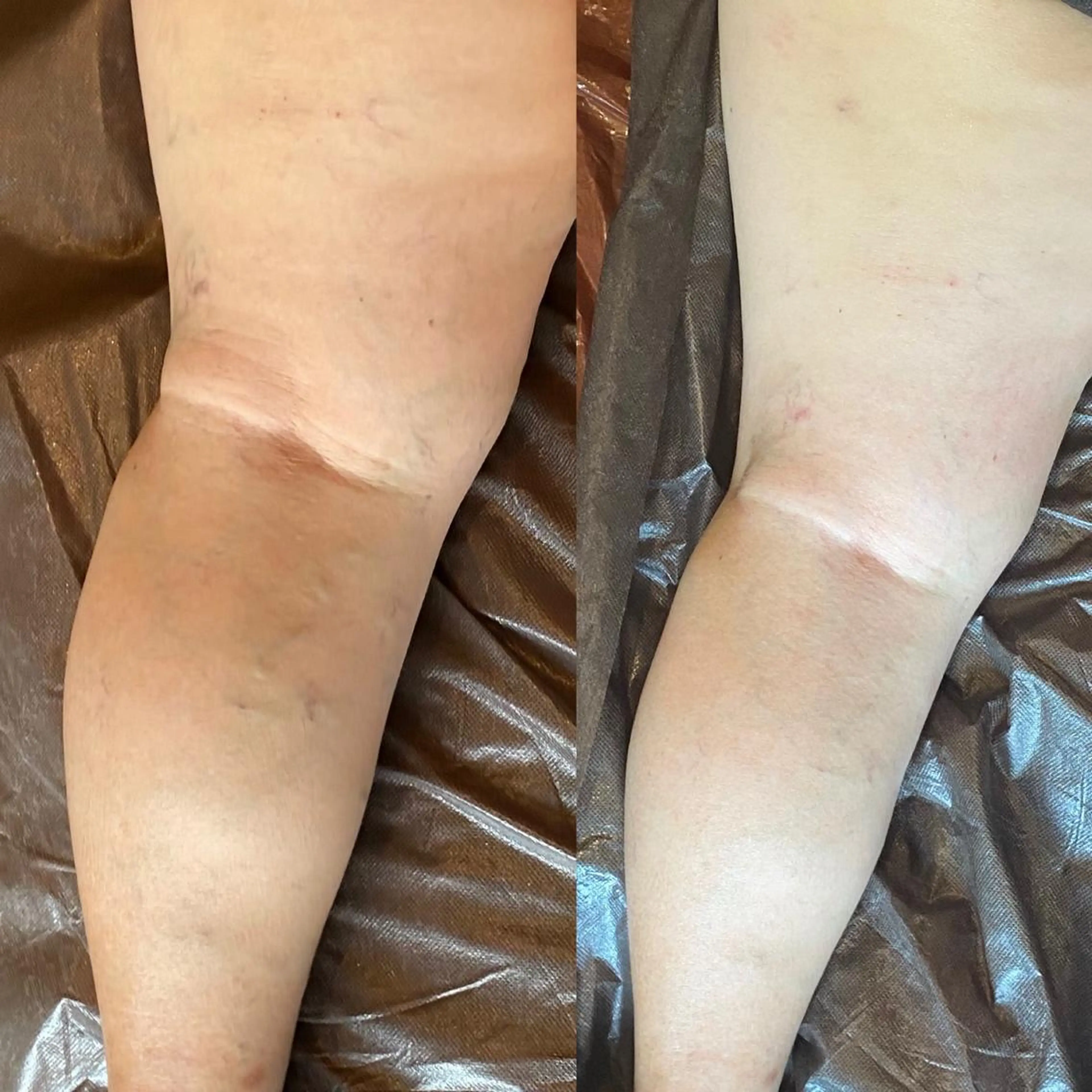 メンズ ネイル エステ リラク AKALA エステ リンパマッサージのエステ・リラクイメージ