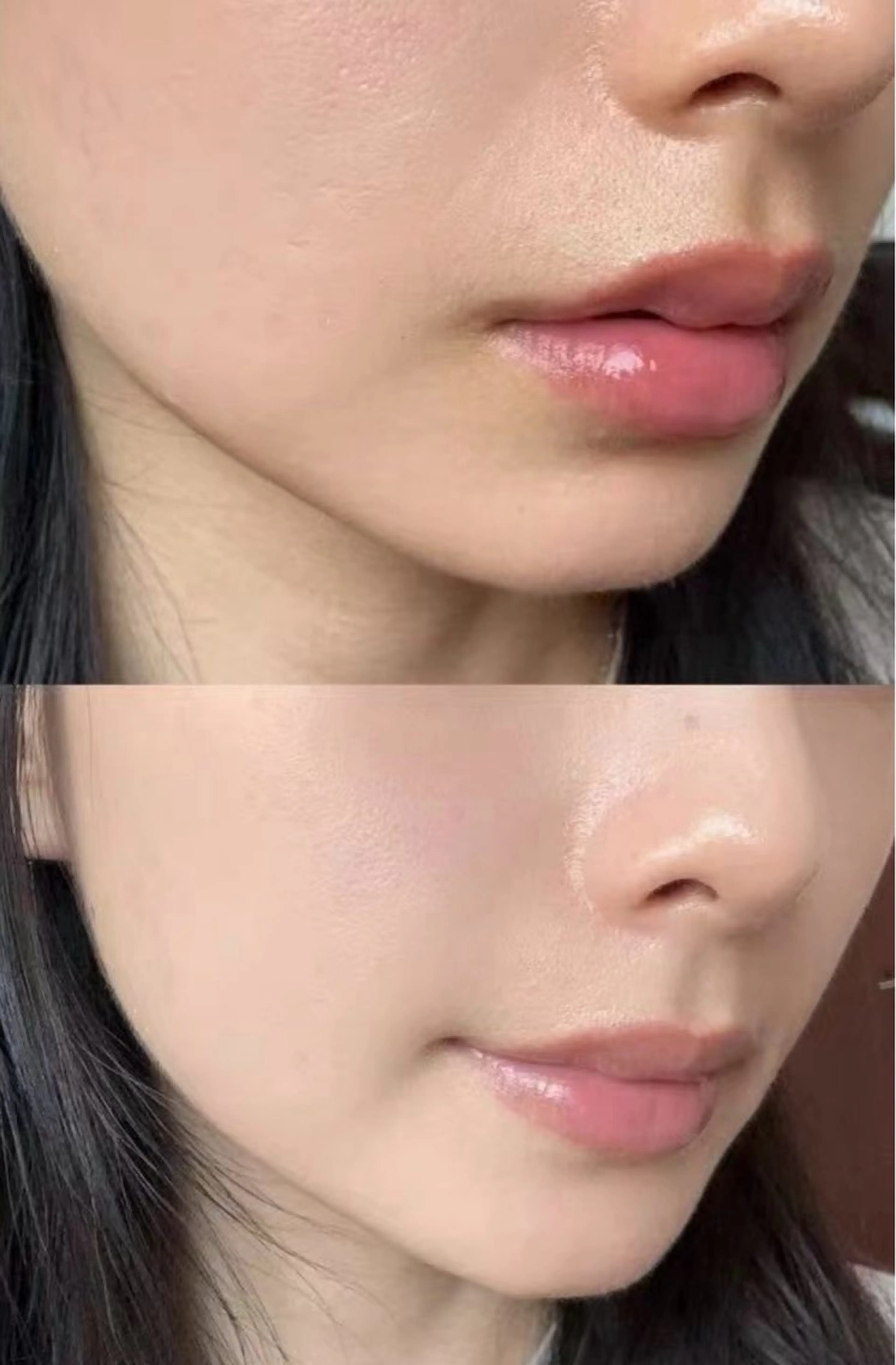 メンズ メンズ韓国風 脱毛 Queen Salonのエステ・リラクイメージ