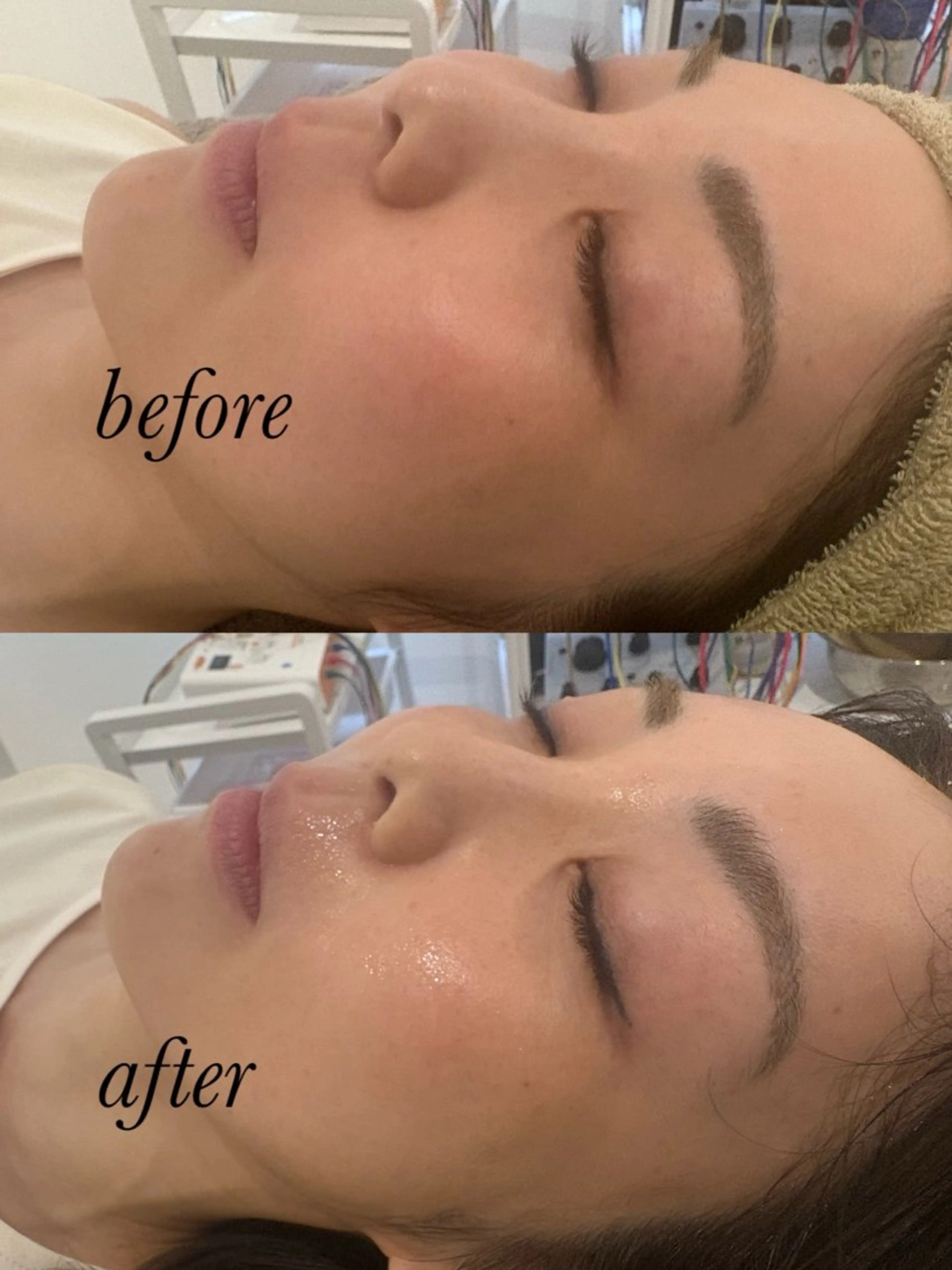 エステ リラク 美容鍼灸サロン mahoroba院長のエステ・リラクイメージ