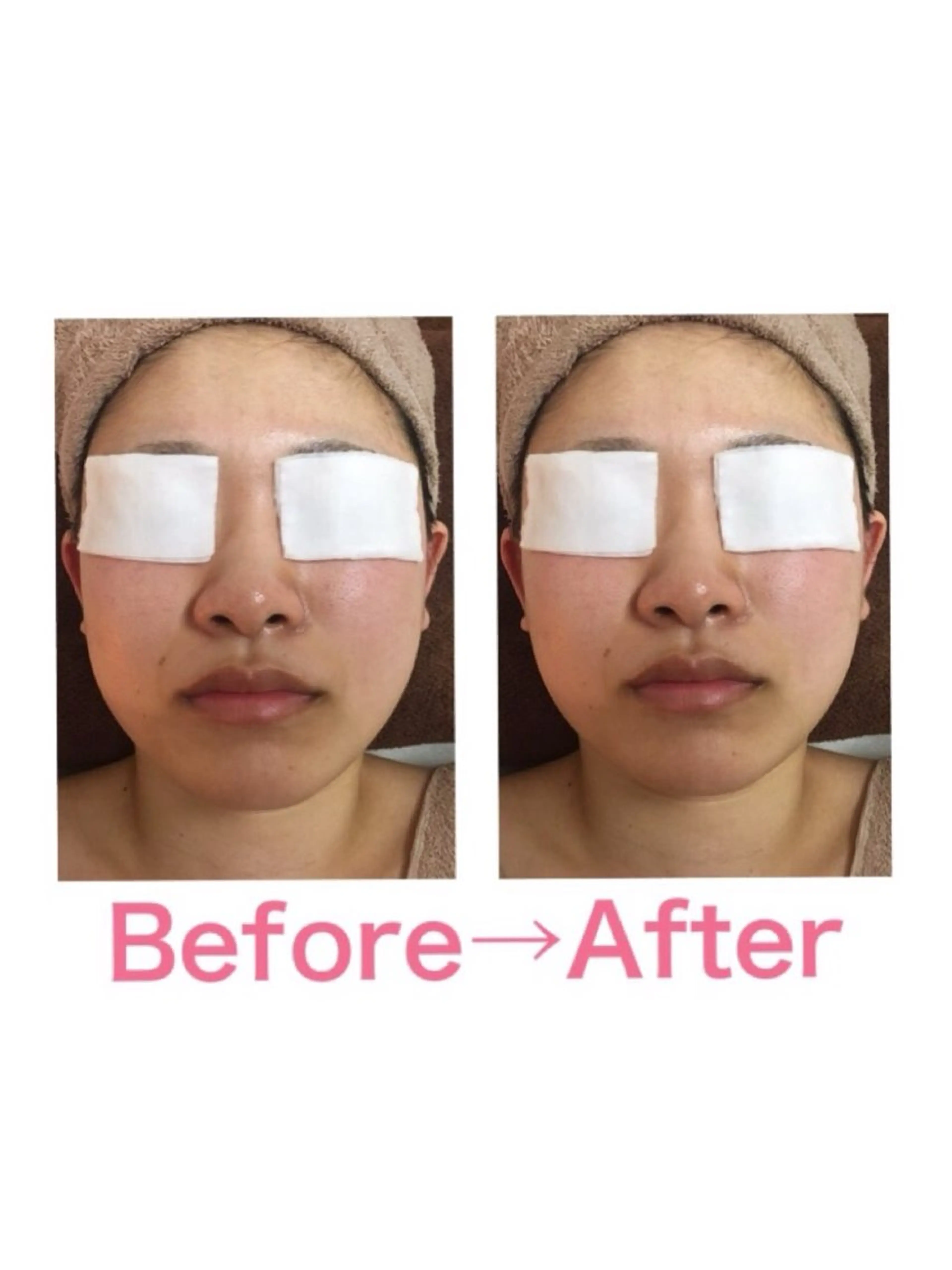 ビューティコア所属・【二子玉川】 ビューティコアのエステ・リラクイメージ