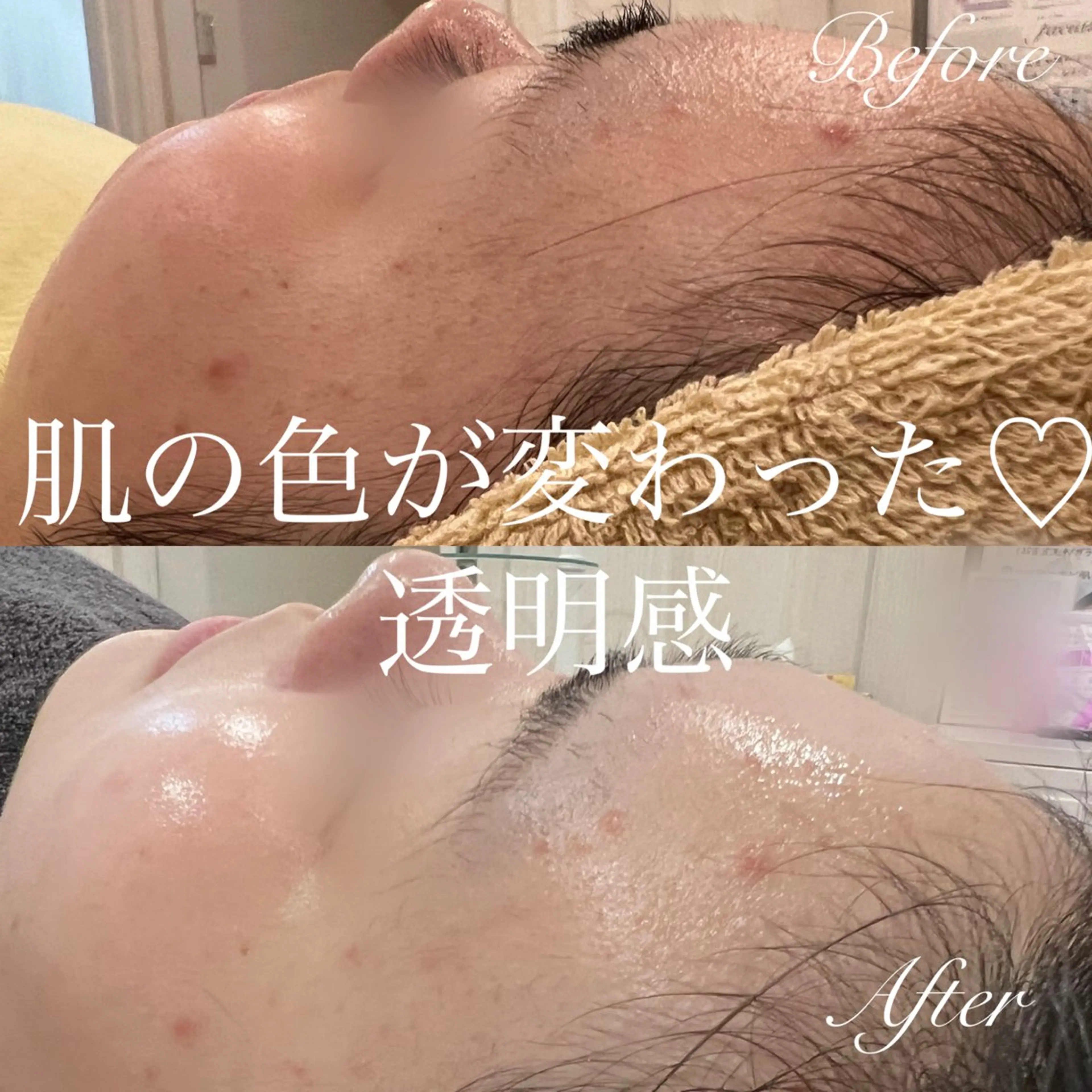 ｍｉkｉ 東根の肌質改善サロンのエステ・リラクイメージ