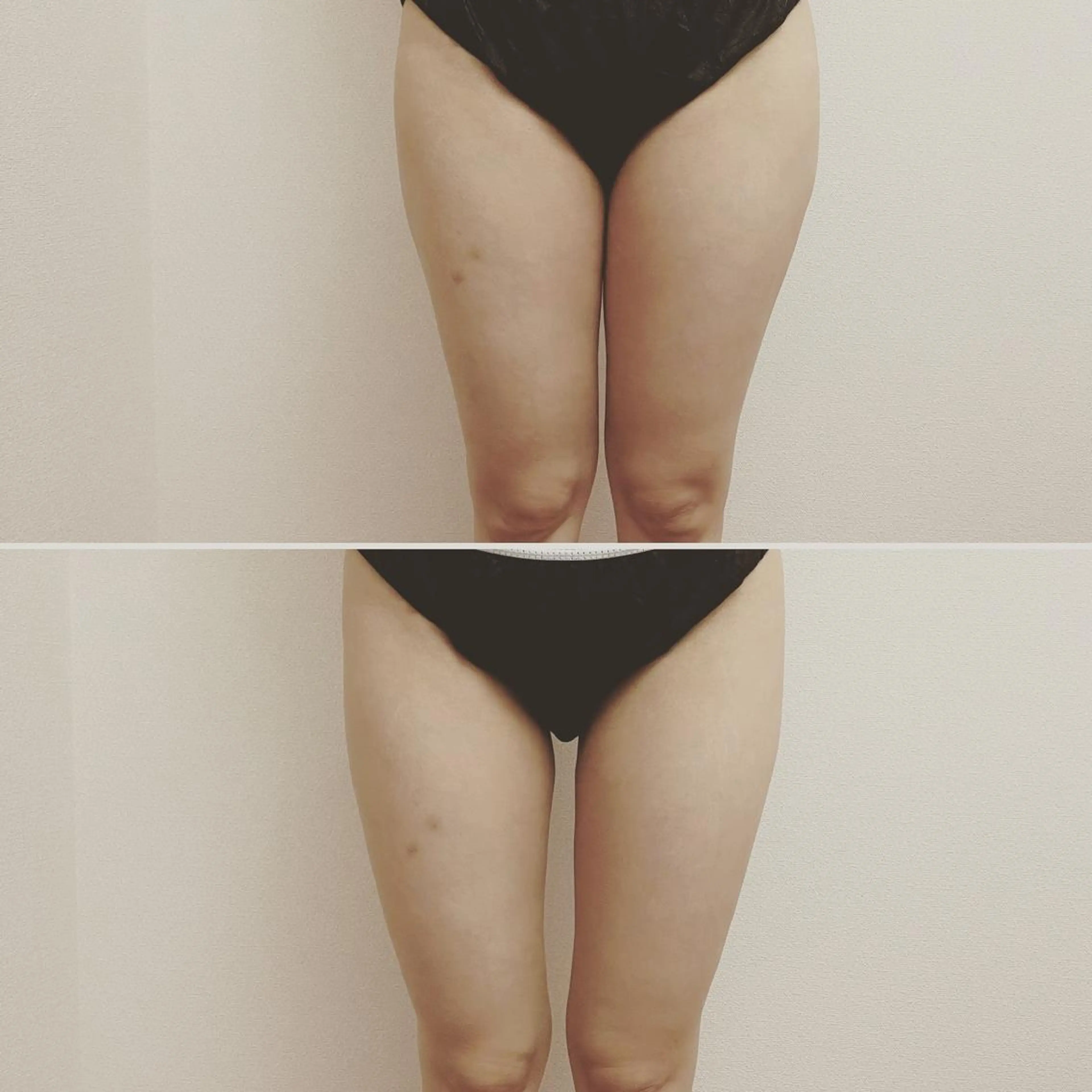 Rainbow 仙台のエステ・リラクイメージ