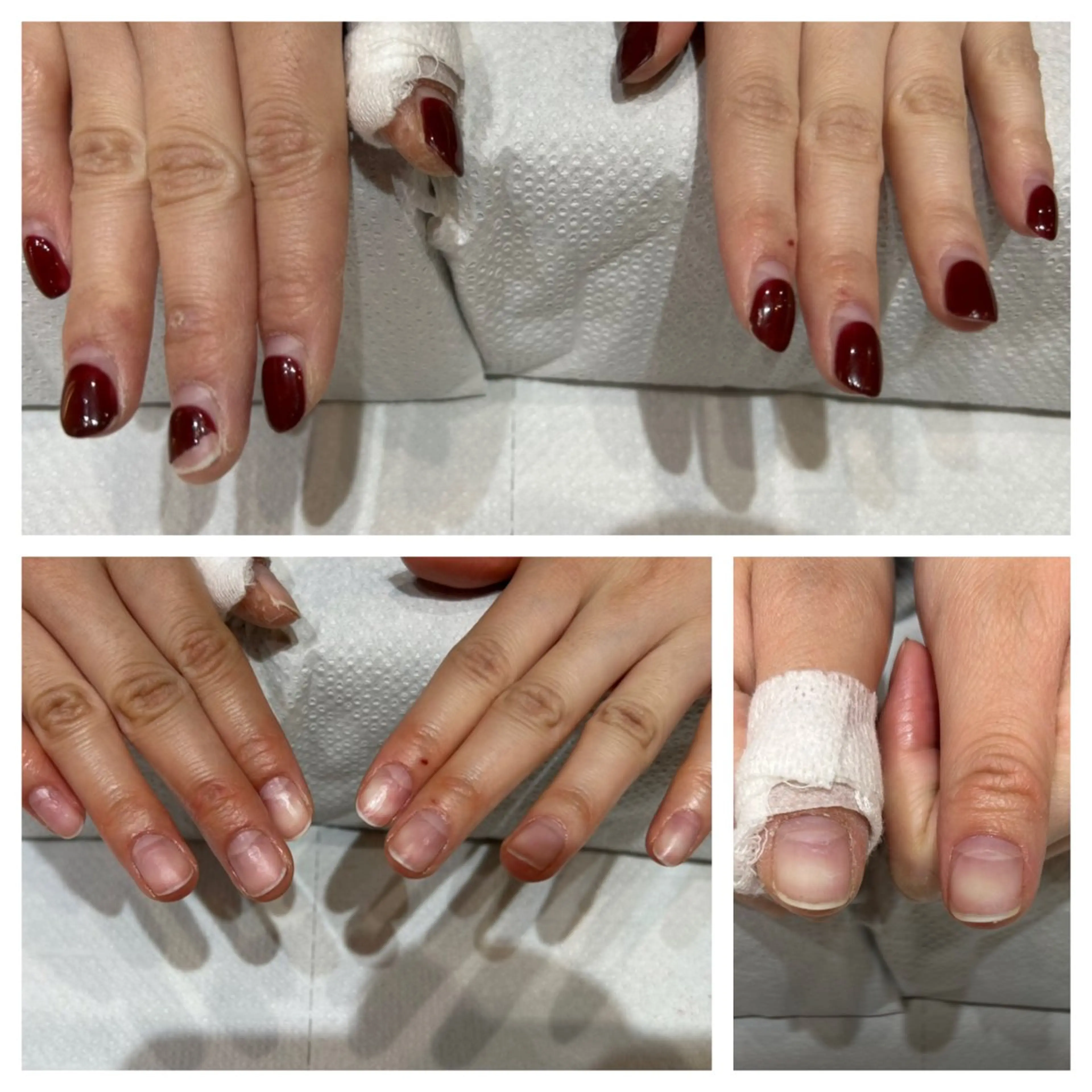 ネイル オフのみ(ネイル) Na＋Nail所属・山口 真莉のネイルデザイン