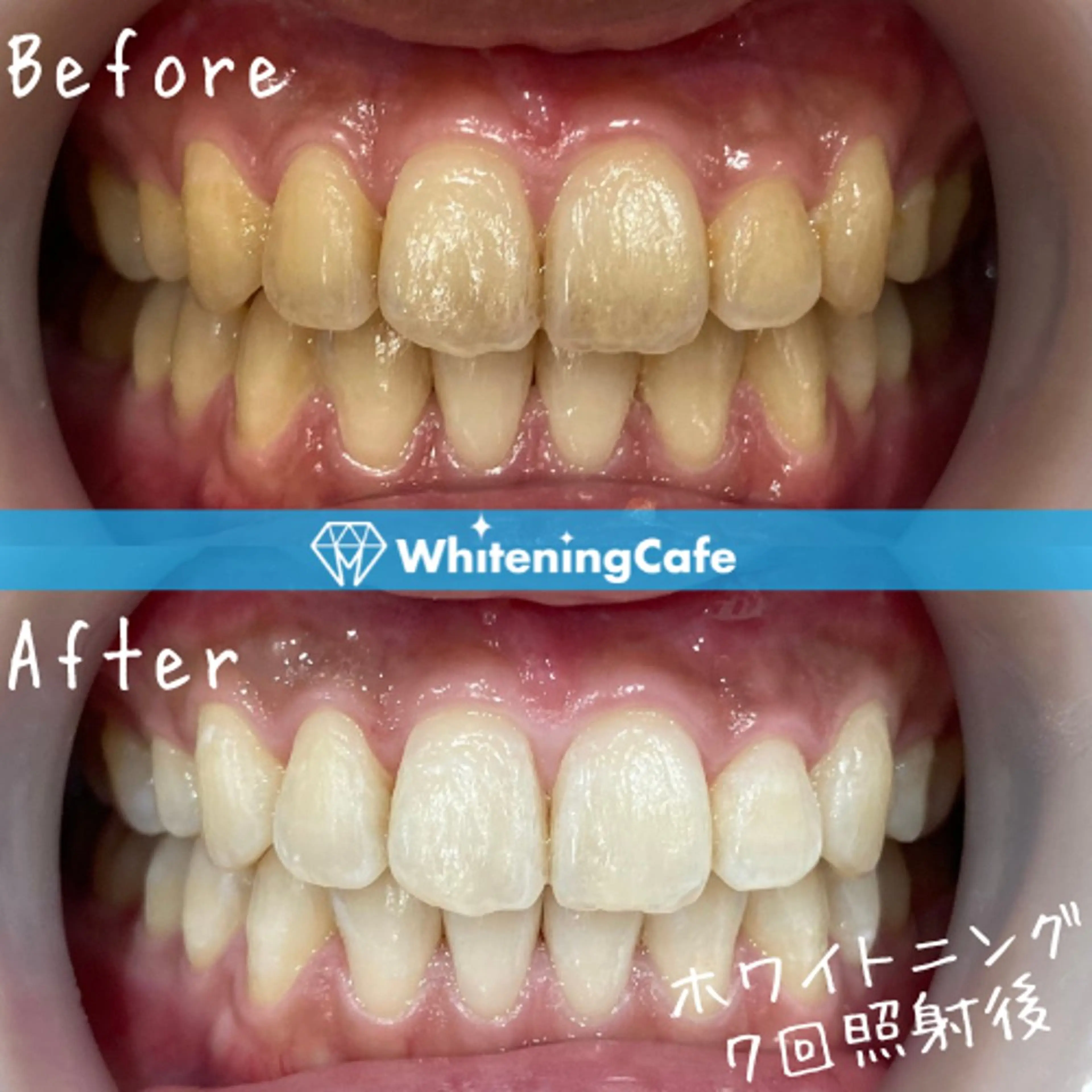 ホワイトニングカフェ神戸元町店所属・ホワイトニングカフェ 神戸元町店のエステ・リラクイメージ