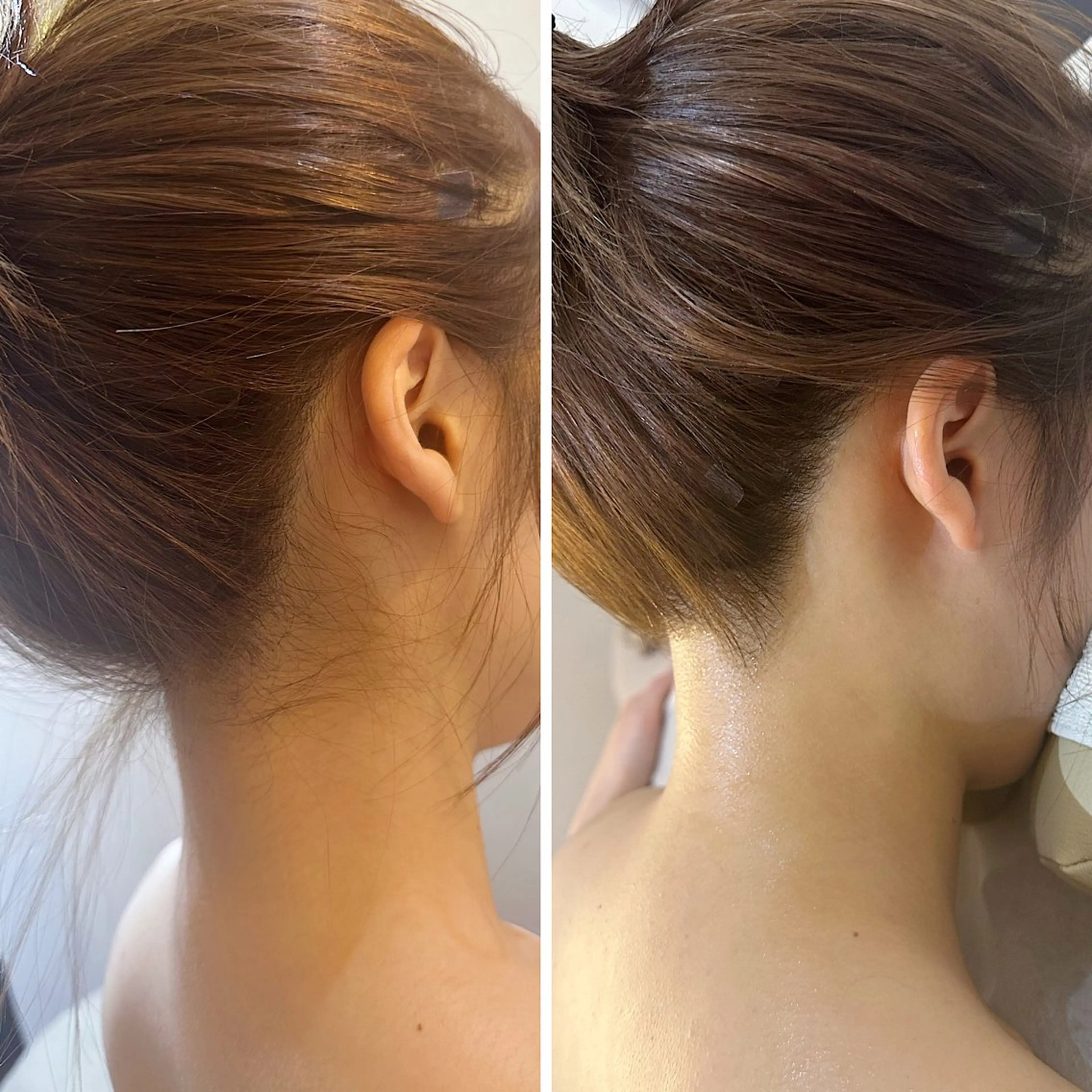 脱毛 うなじ脱毛/美肌脱毛 LABELのエステ・リラクイメージ