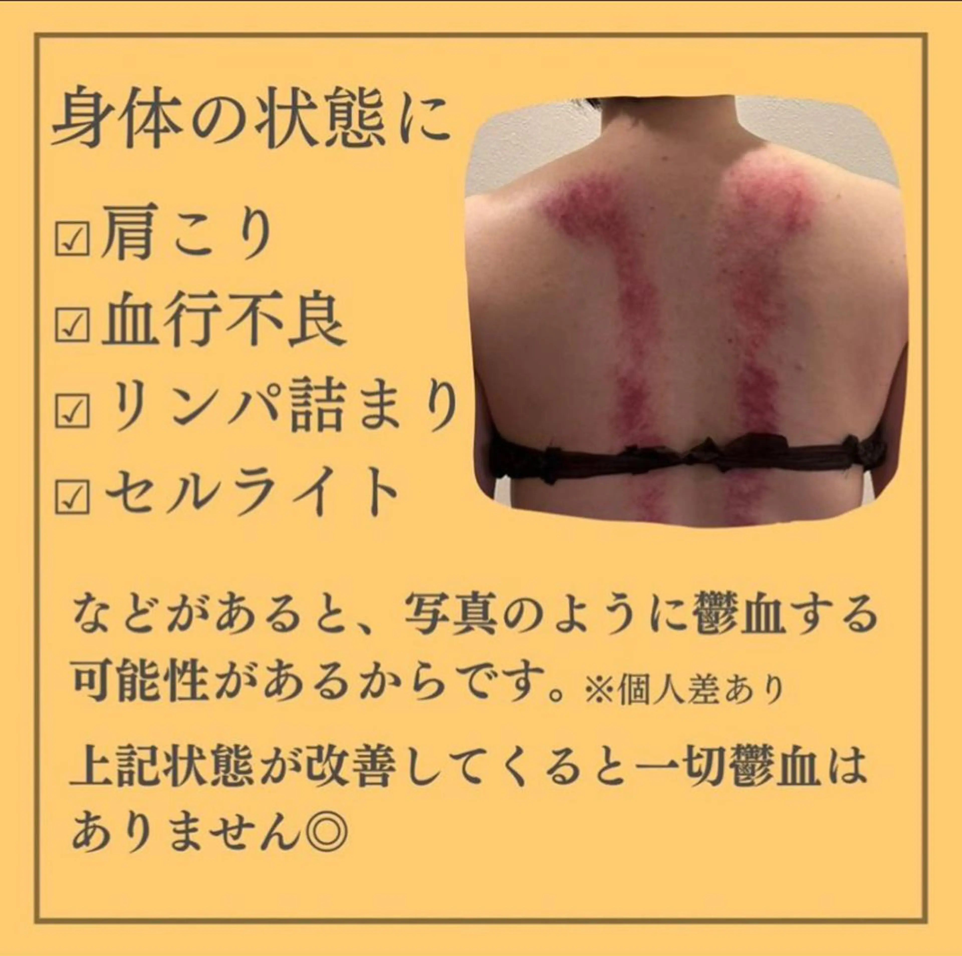 🎀葛野 日向子🎀のエステ・リラクイメージ