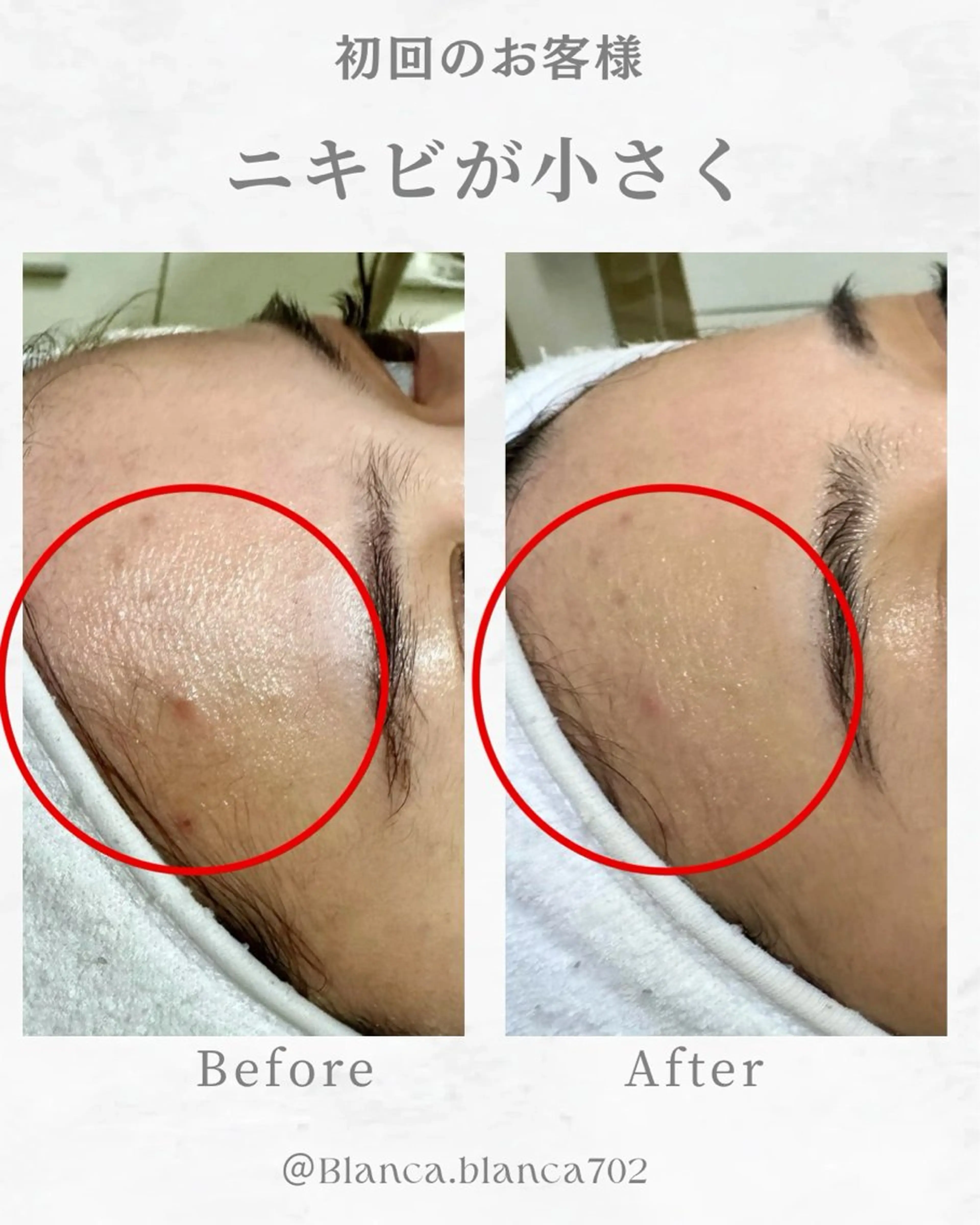 エステ プライベートエステサロンBlanca所属・Blanca ナミキのエステ・リラクイメージ