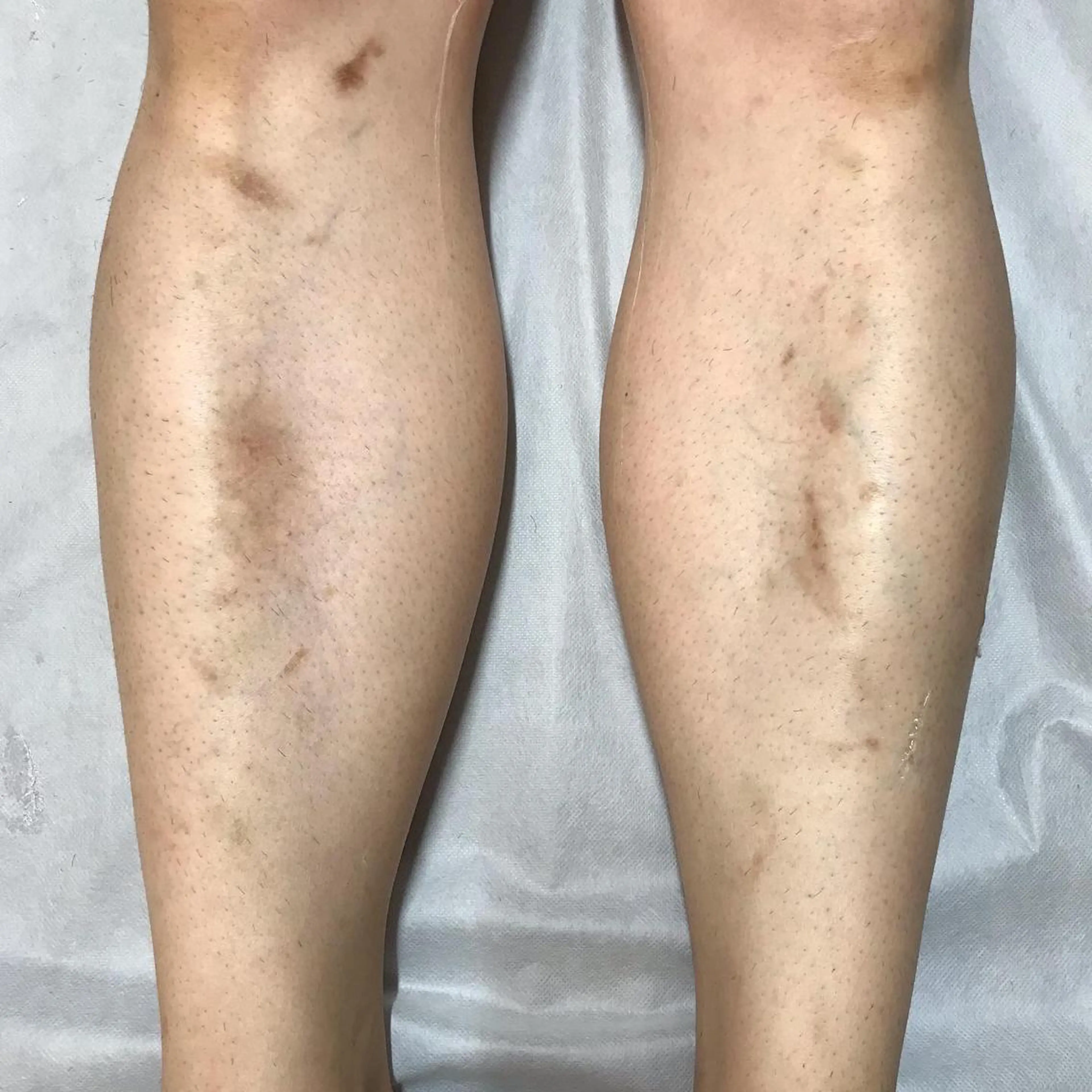 Lilyboo 星のエステ・リラクイメージ