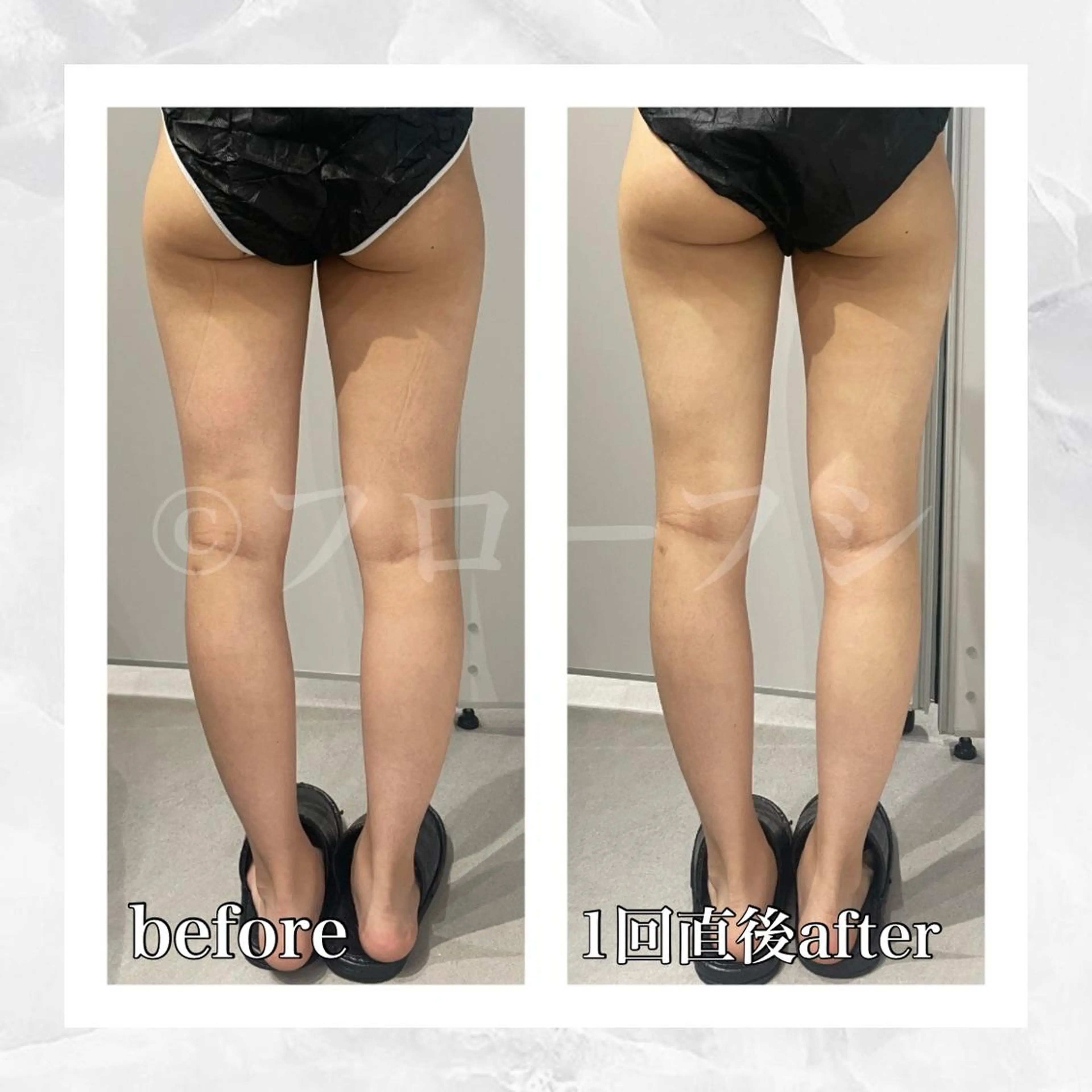 エステ リラク 部分痩せ♥️小顔専門 MIKUのエステ・リラクイメージ