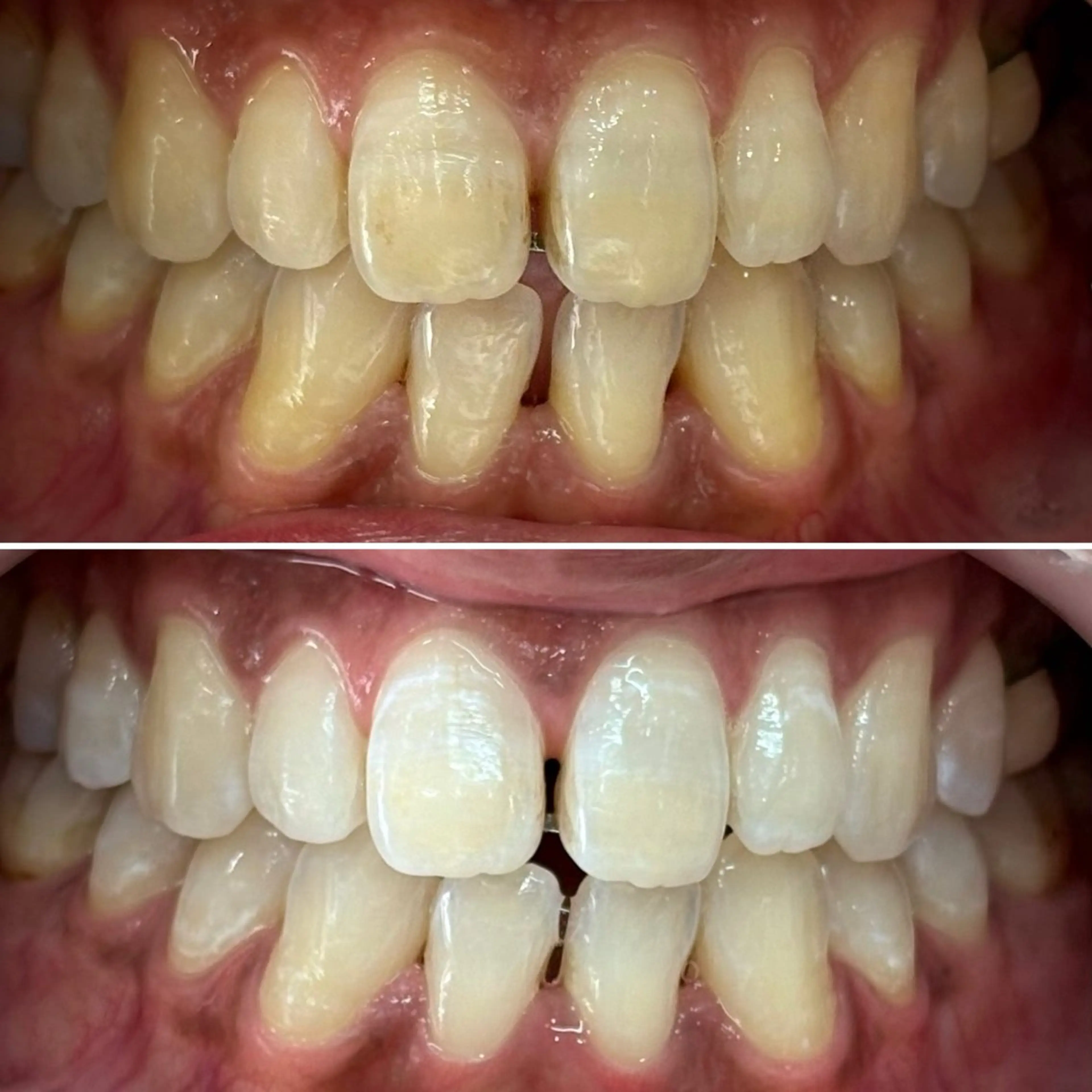 その他 whitening salon yatto.所属・ホワイトニングサロン yatto.のその他イメージ