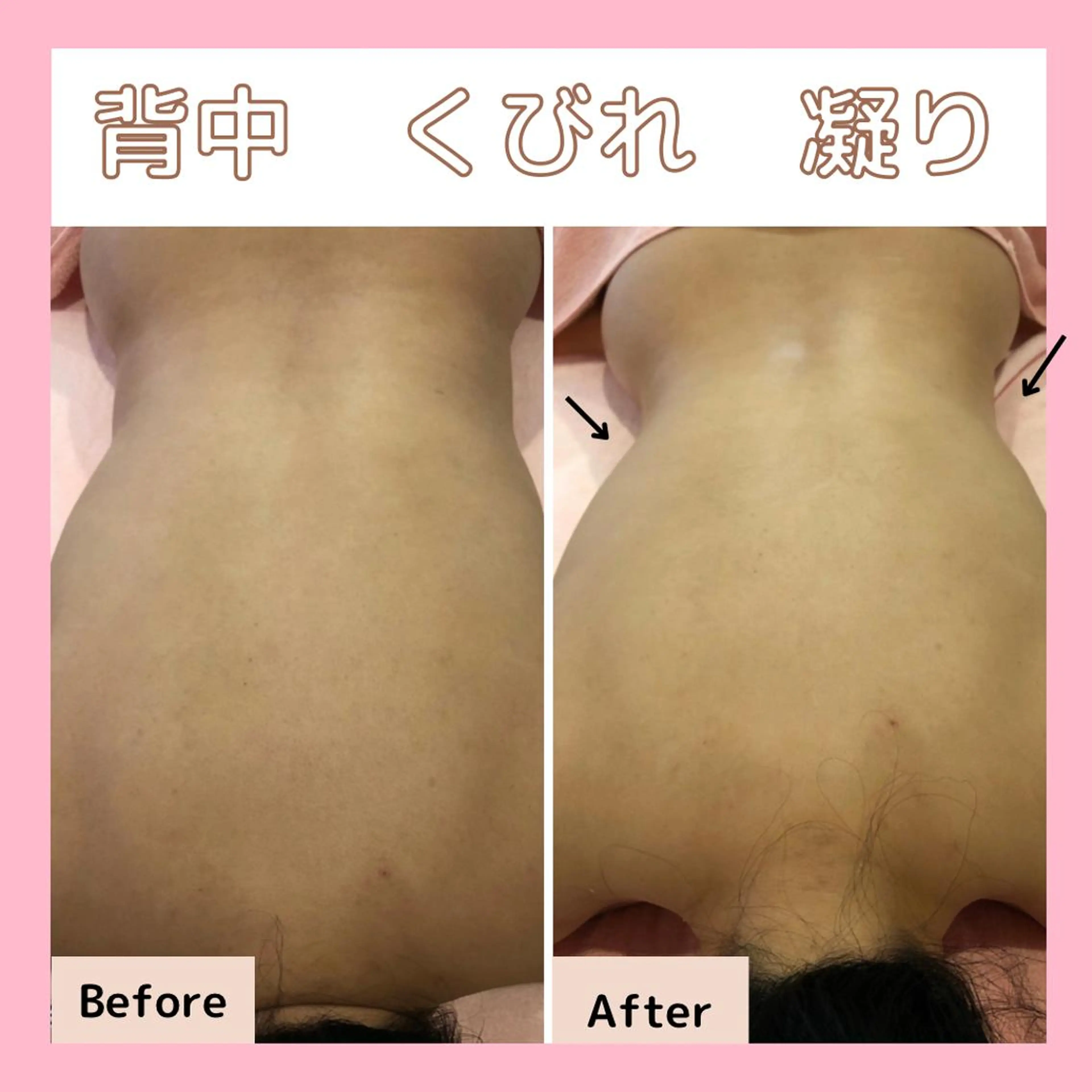 エステサロン　Sブランペタル所属・三沢市エステサロン Sブランペタルのエステ・リラクイメージ