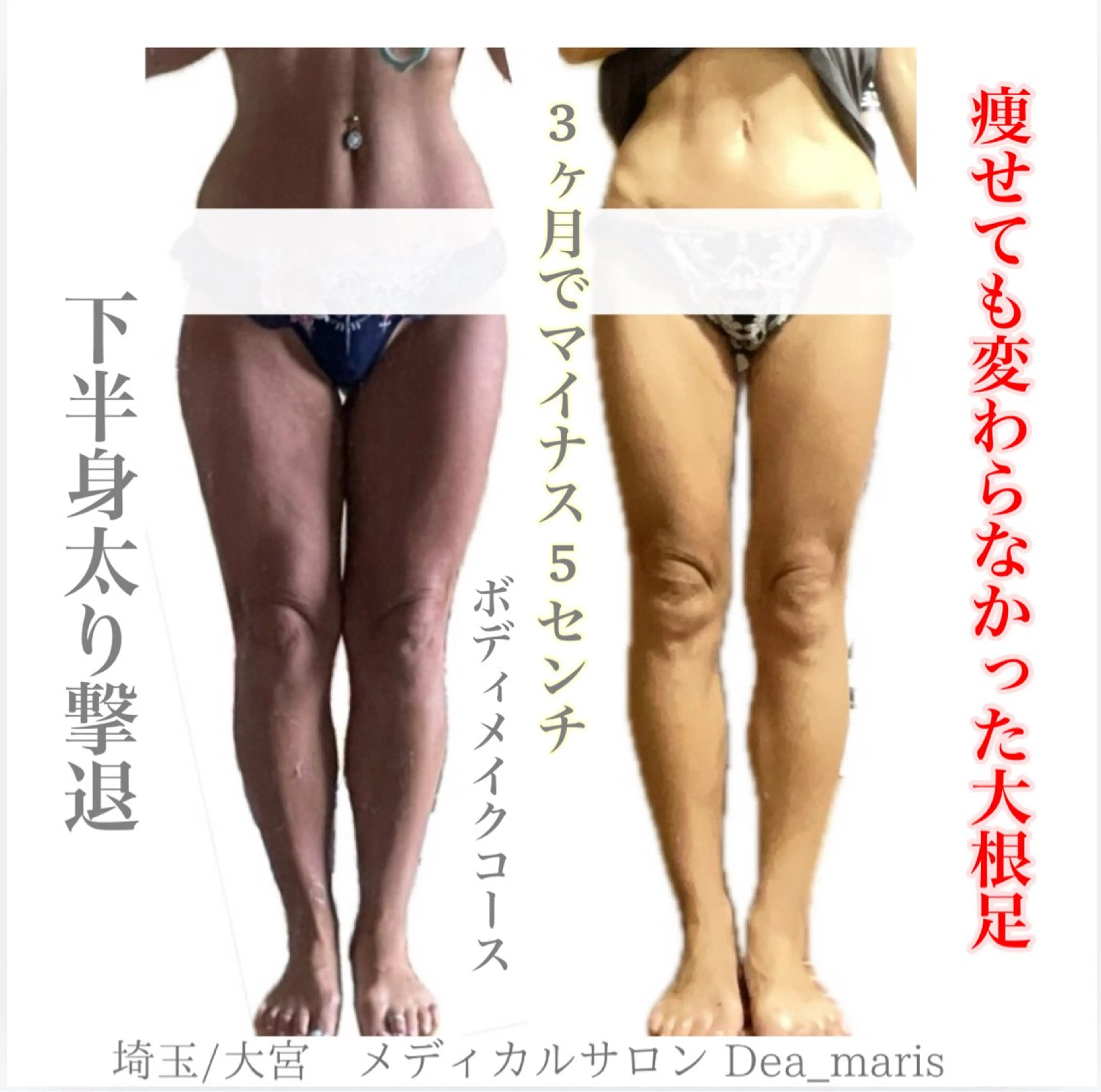 private salon  Dea_maris シュガーリング＆パーソナルボディケア所属・シミ改善・韓国肌管理 ボディメイク痩身のその他イメージ