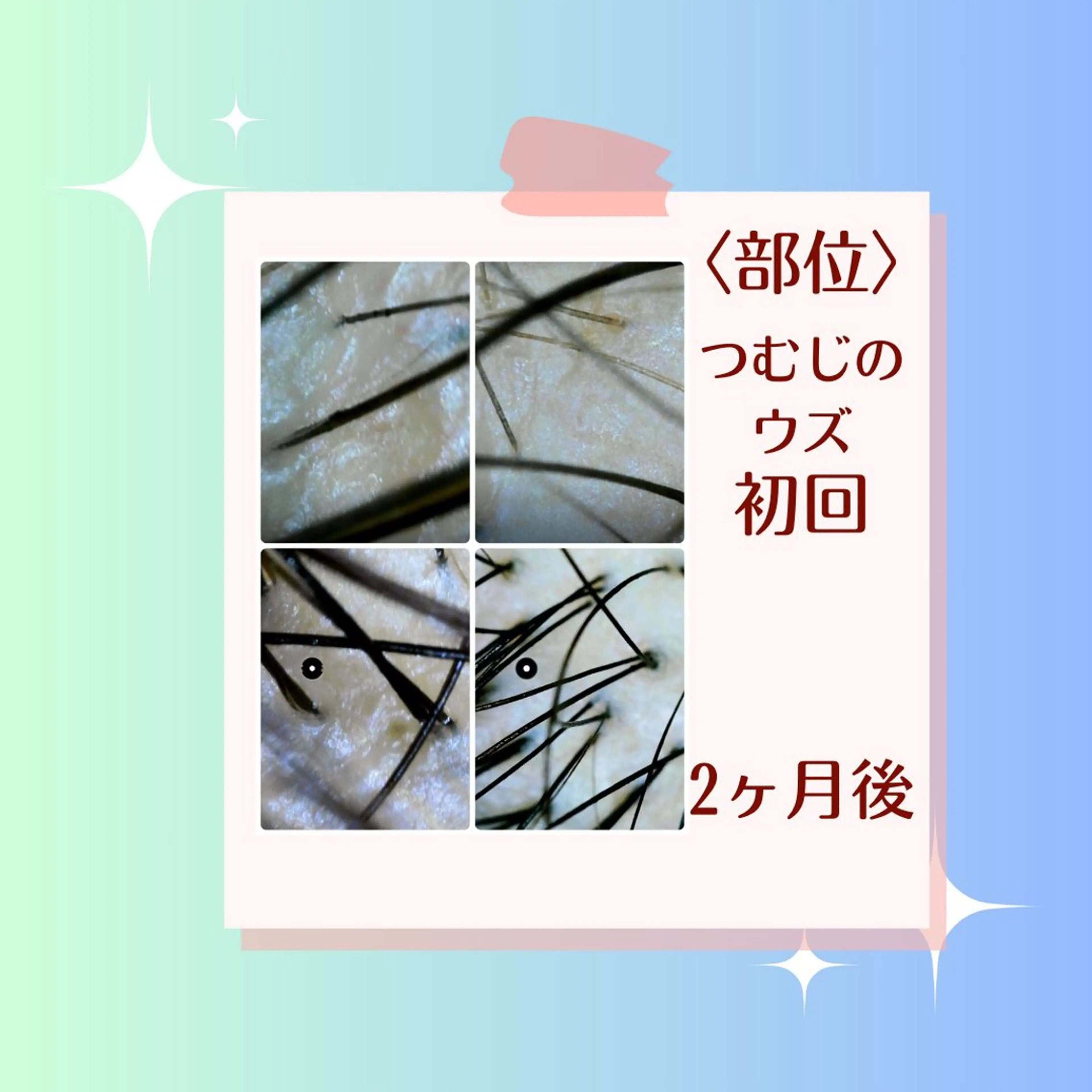 かすがい鍼灸院Re.heart所属・かすがい鍼灸院 Re.heartのエステ・リラクイメージ