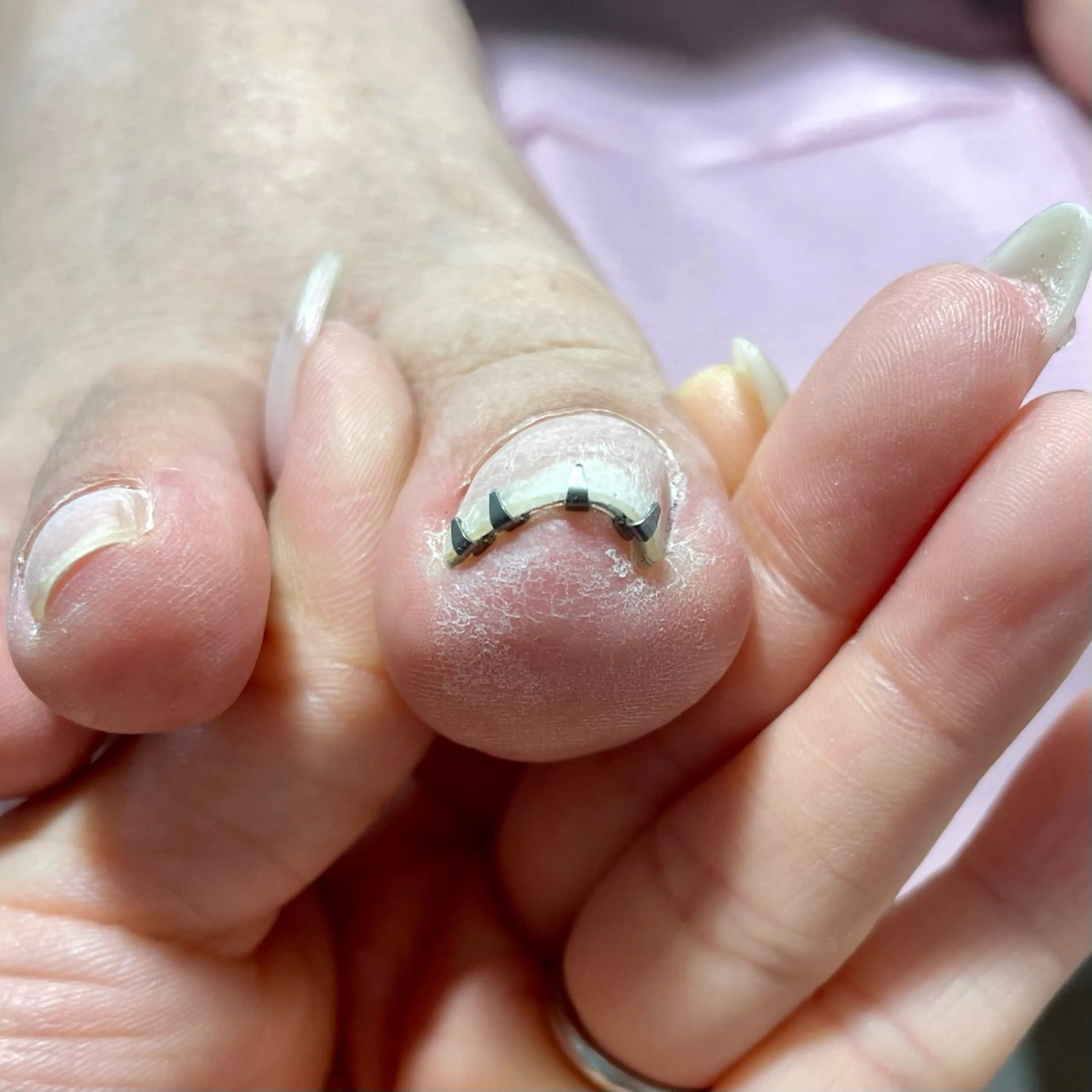 ネイル nail salon ワンミリオンのネイルデザイン