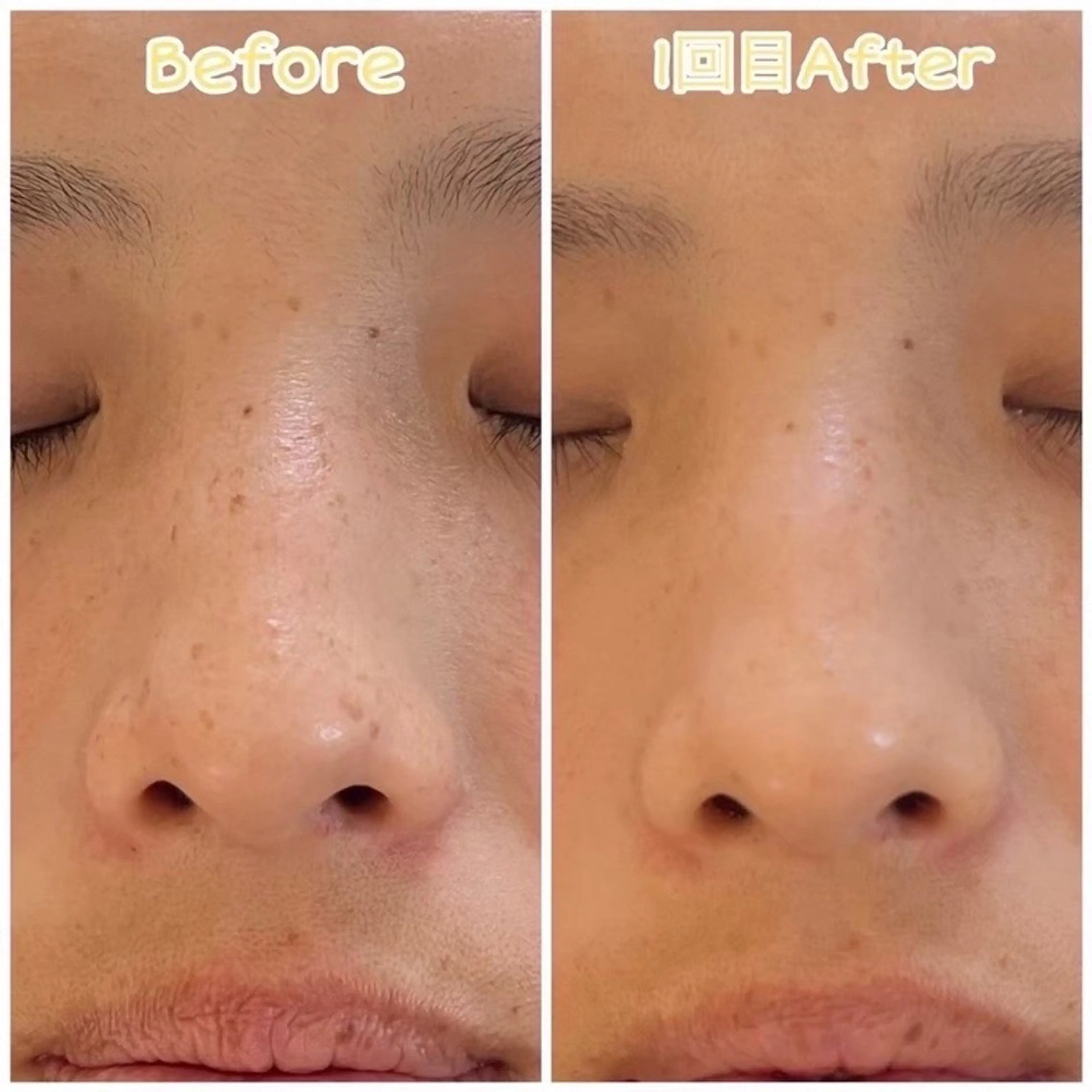 RICHEBELLE所属・樋口 端咲のマツエク・マツパデザイン