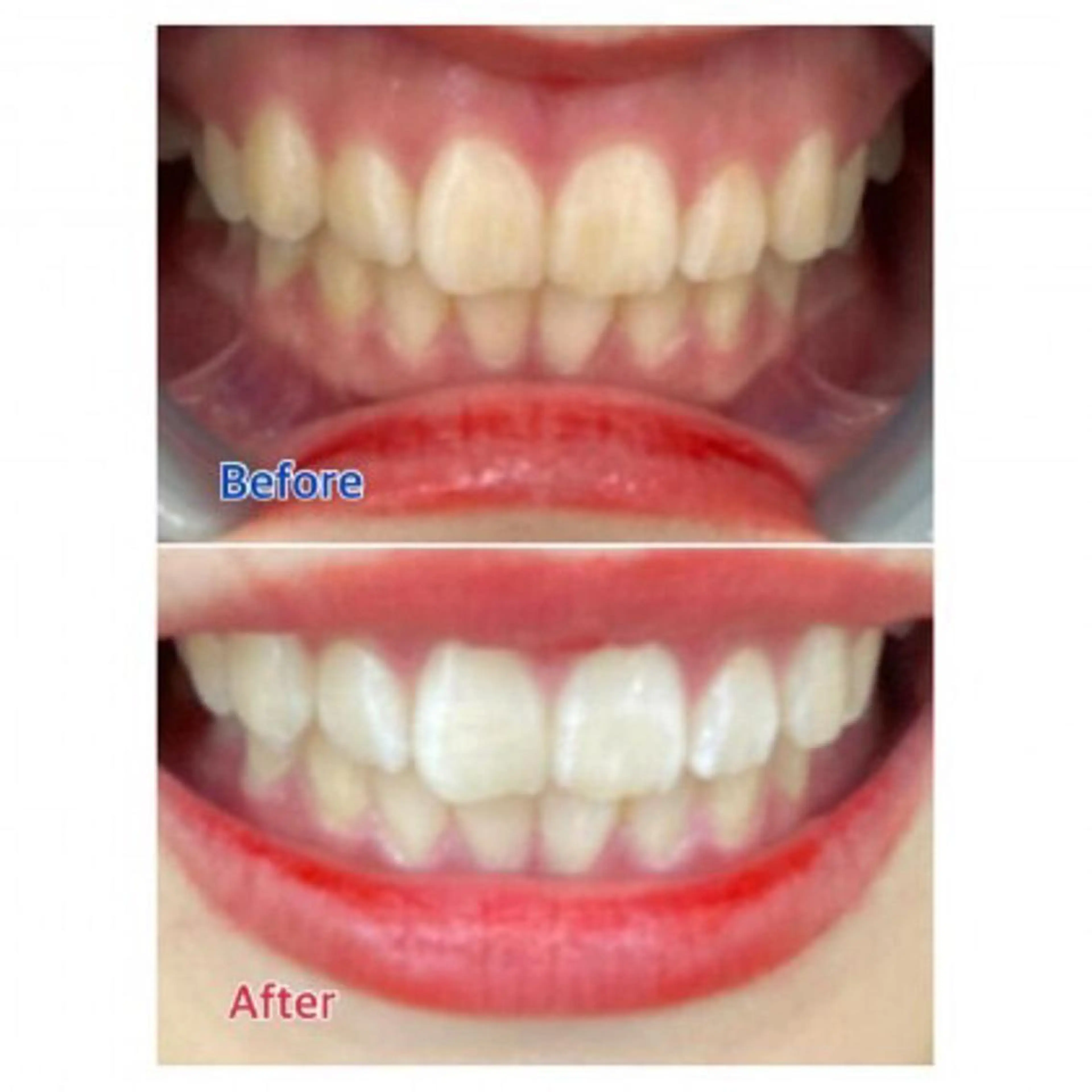 M渋谷店所属・Ｍ渋谷 ホワイトニングのエステ・リラクイメージ