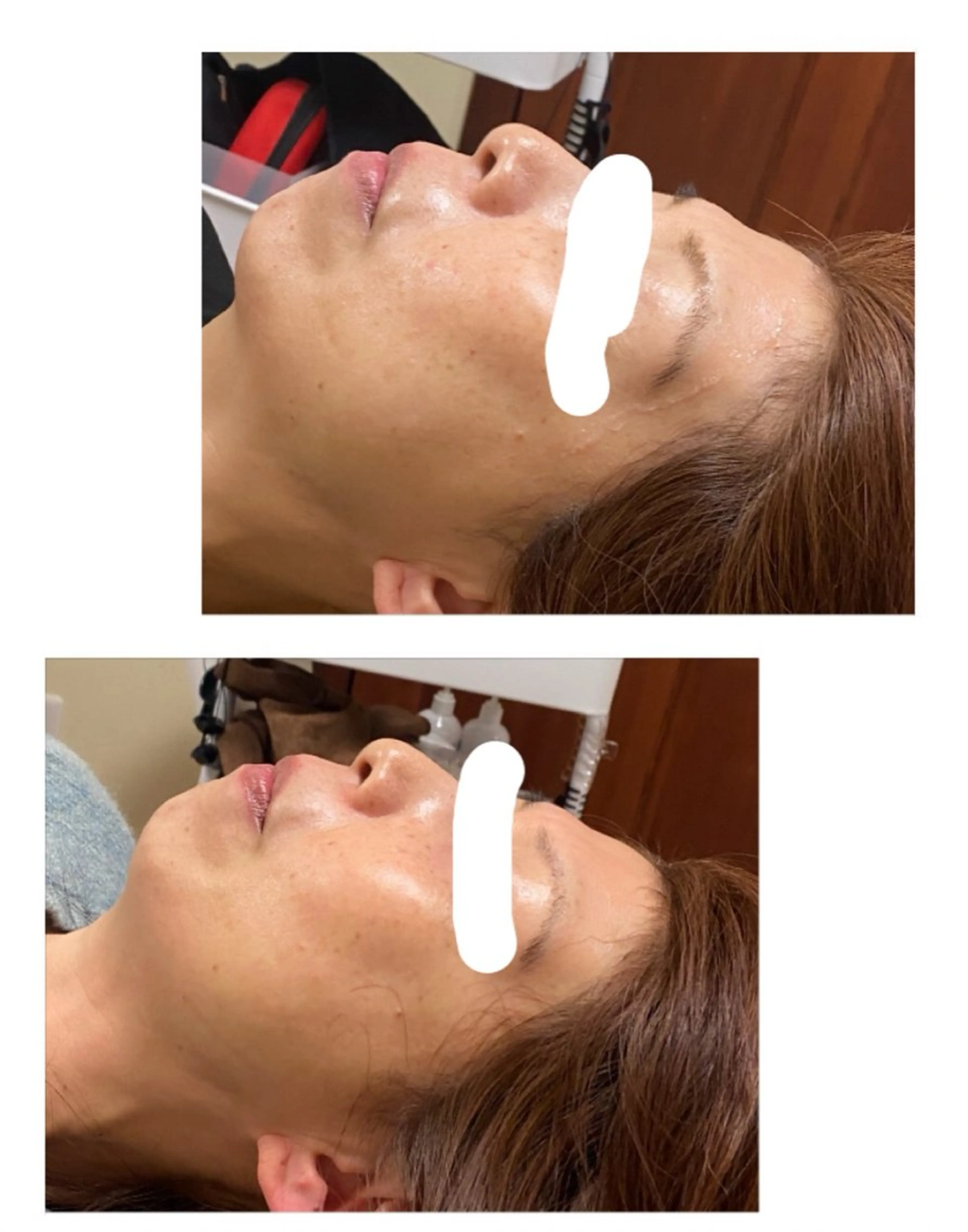 その他 ネイル＆脱毛 Lotus🌸のネイルデザイン