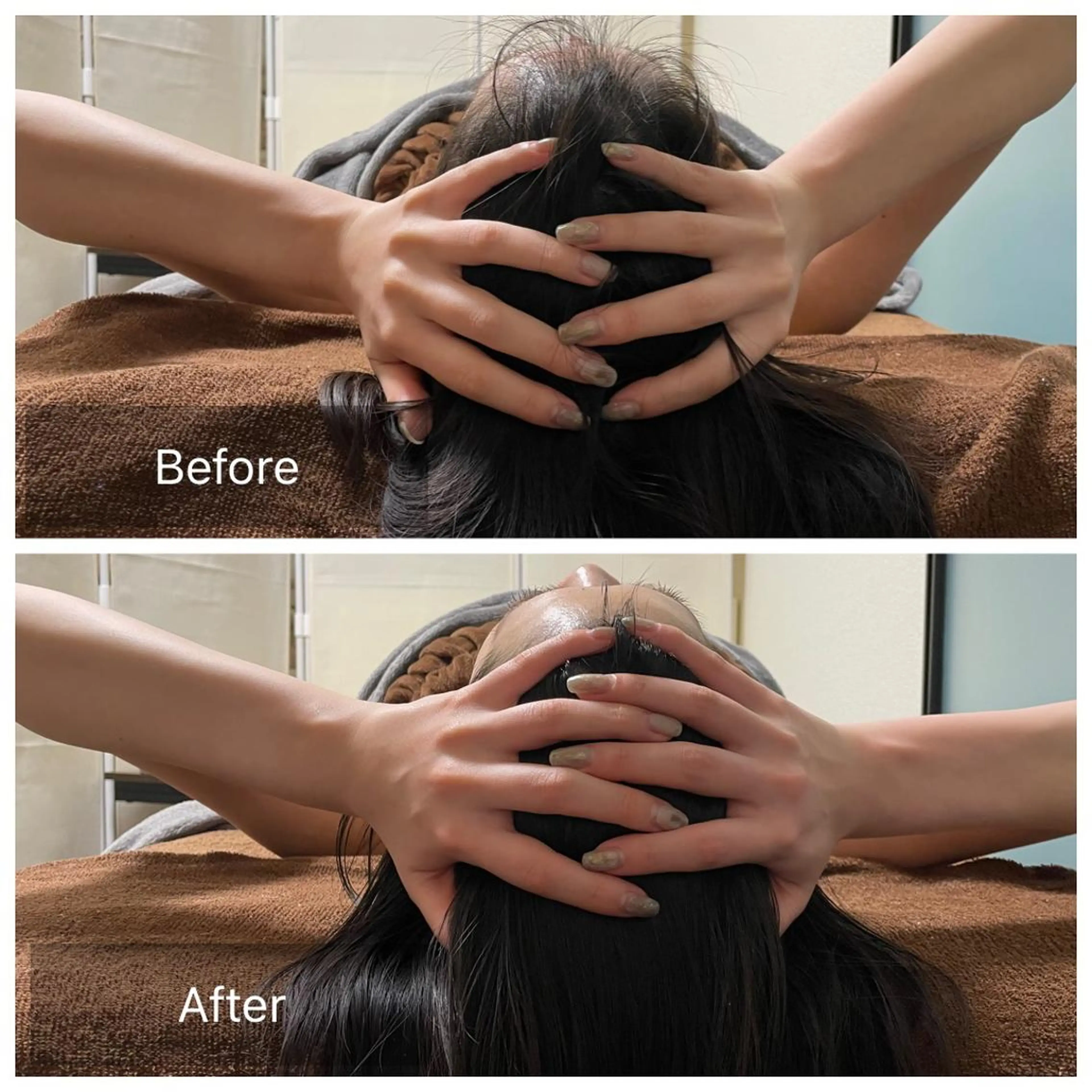 ヘッドトリートメントの写真