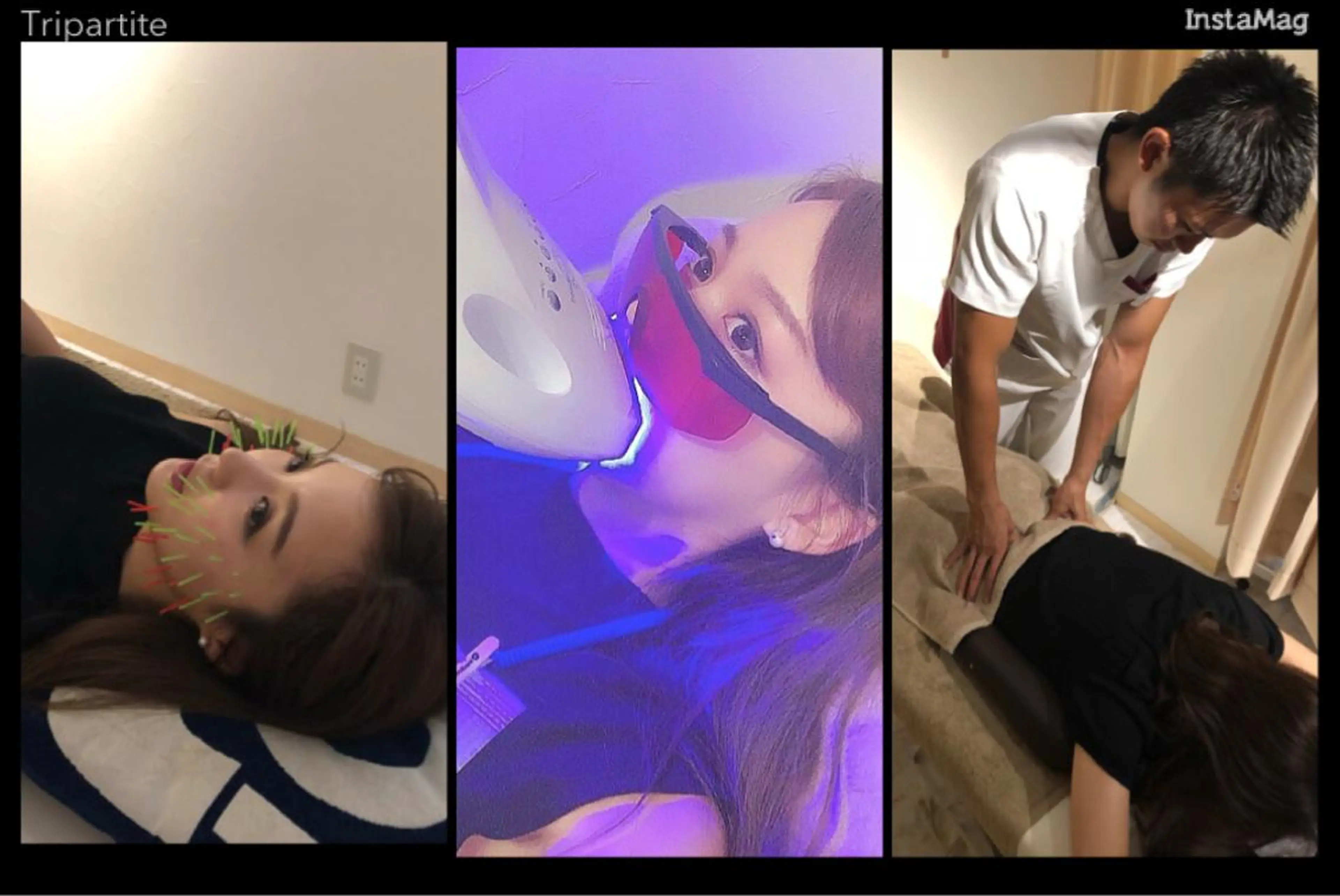 贅沢セット🙆‍♂️【美容鍼×ホワイトニング×美容整体】こんなセットメニューは当院のみ🤗の写真