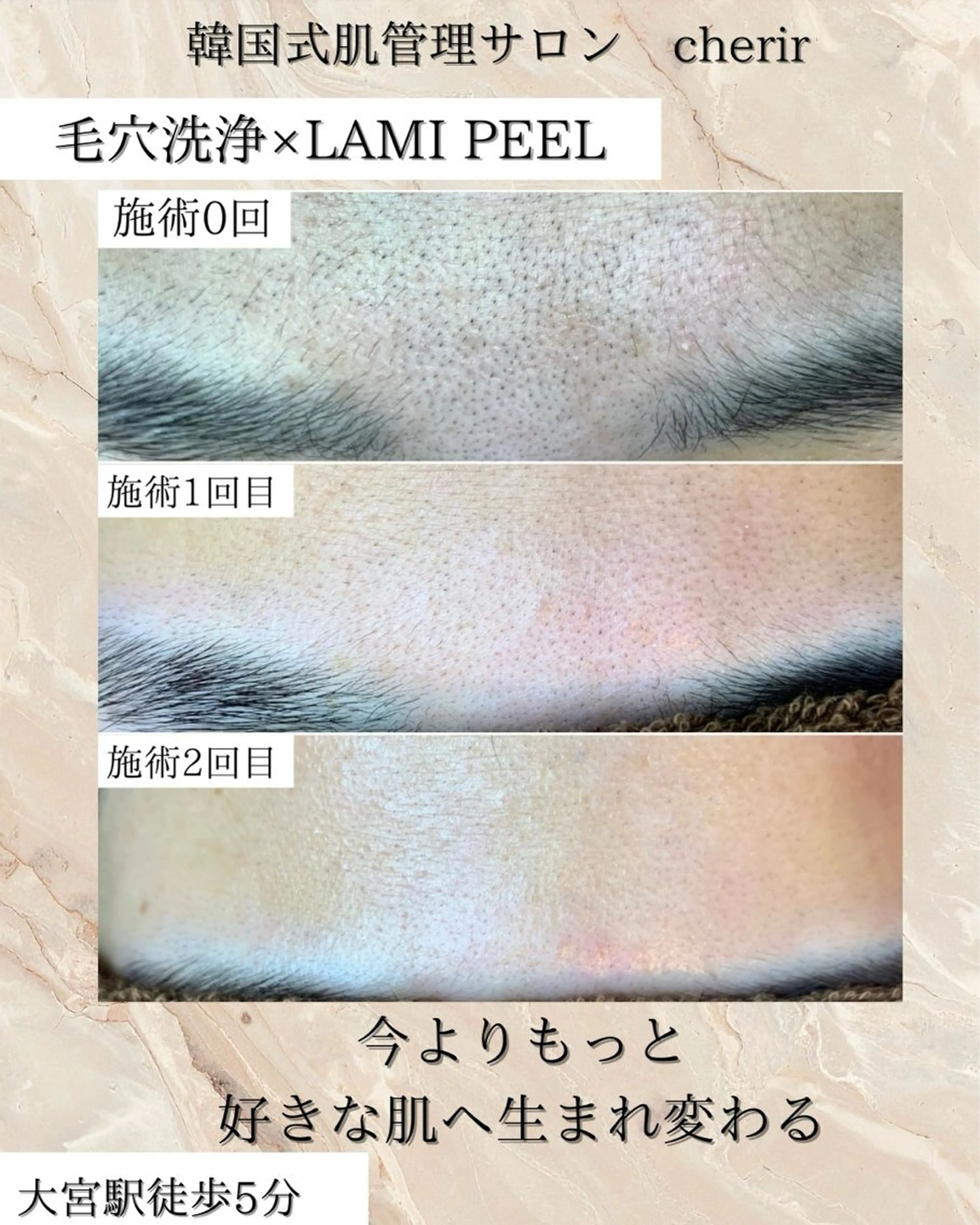 cherir アミのエステ・リラクイメージ