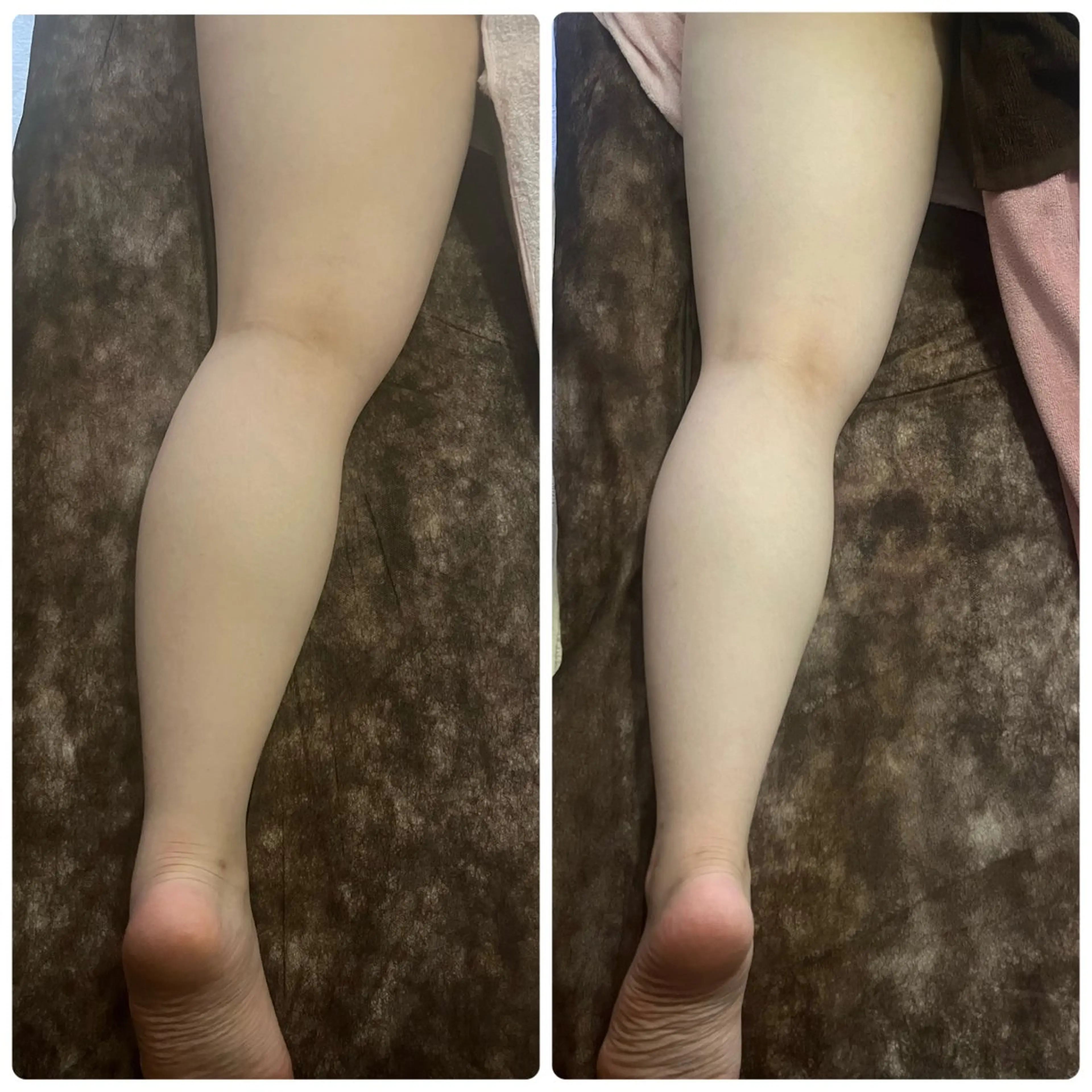 アロマ･美容鍼･カッ ピング「麗」鍼灸院のエステ・リラクイメージ