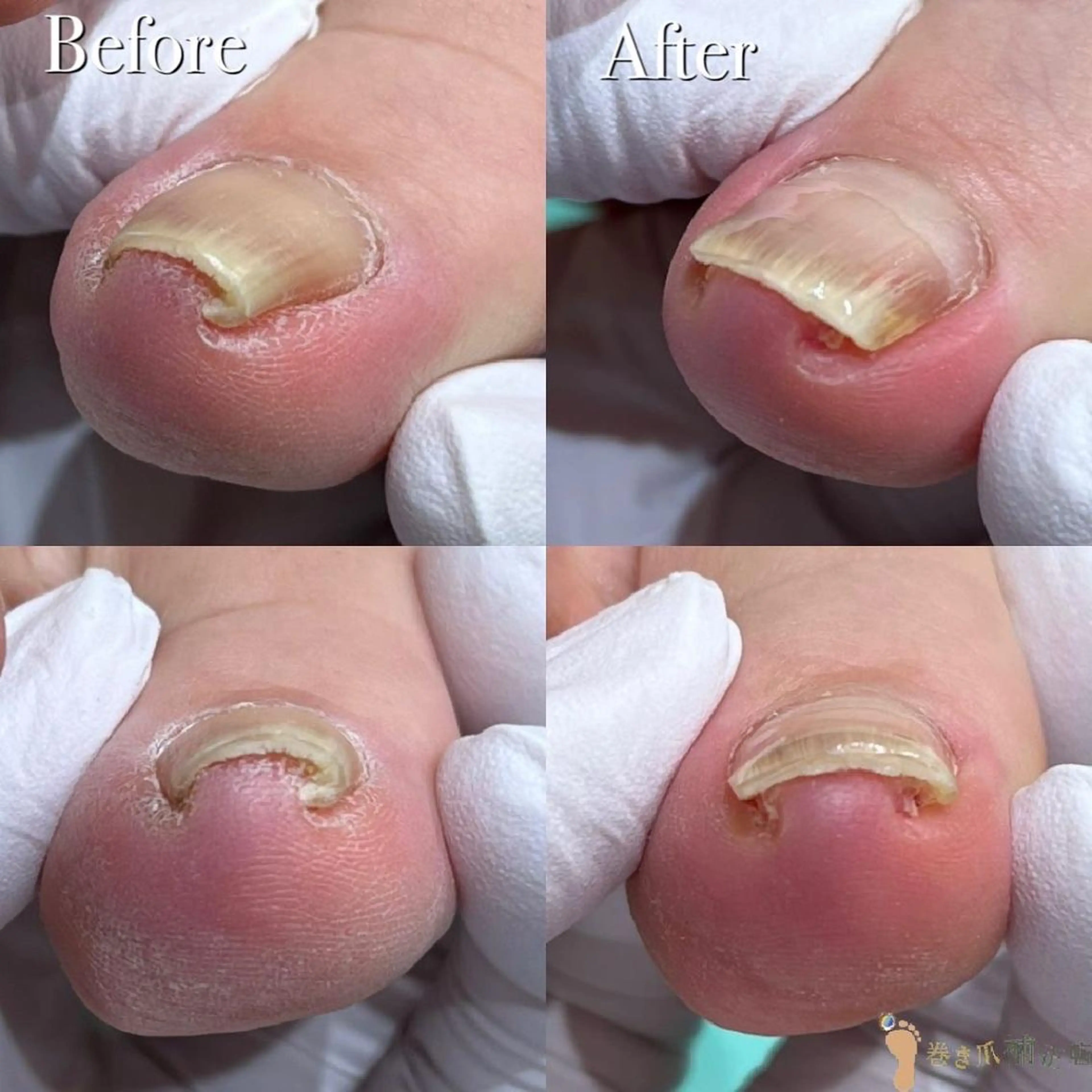 ネイル 東京巻き爪アカデミー所属・東京巻き爪 アカデミーのエステ・リラクイメージ