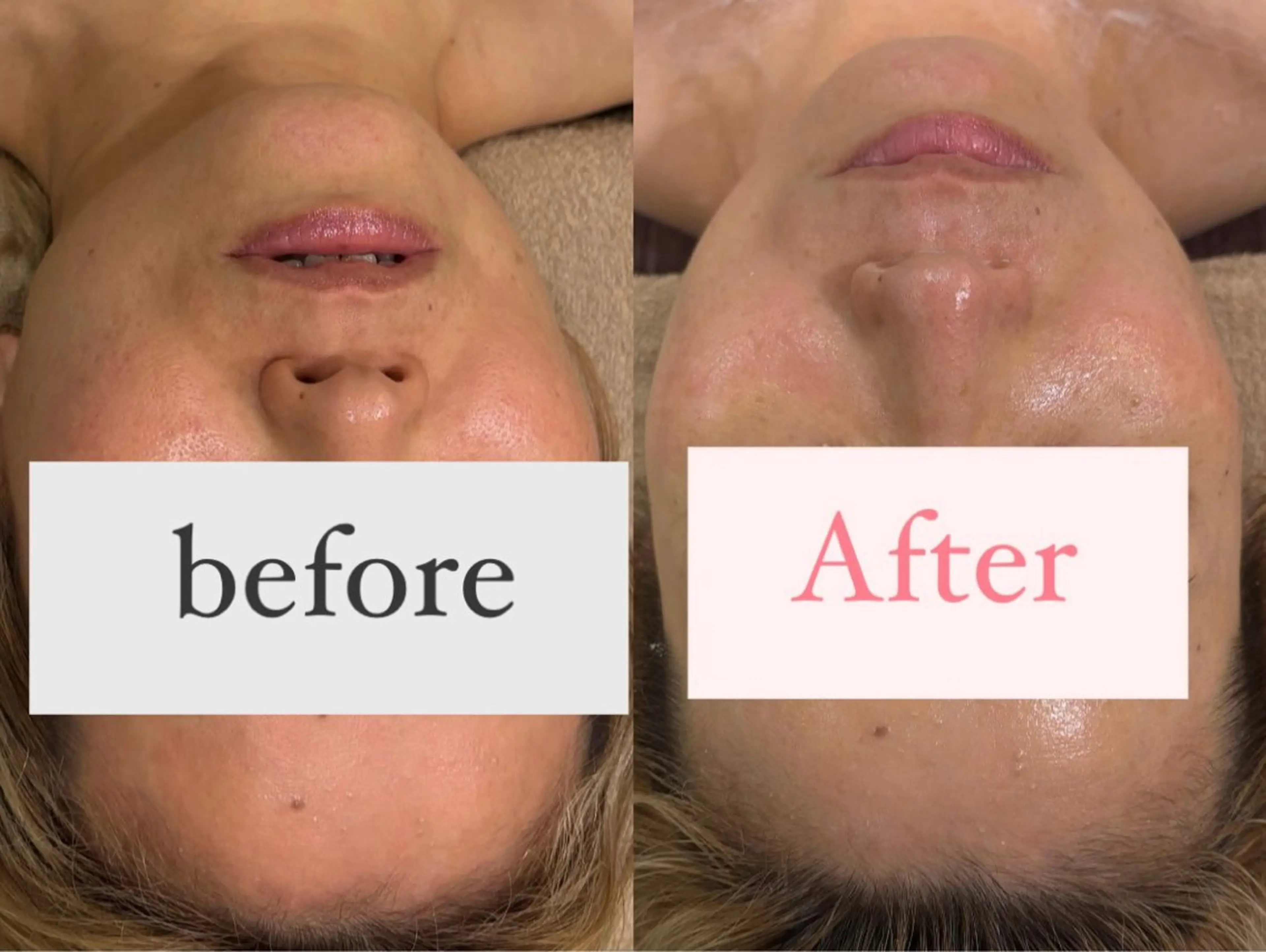 メンズ ルリアン　ガーデン所属・大山 彩能のエステ・リラクイメージ