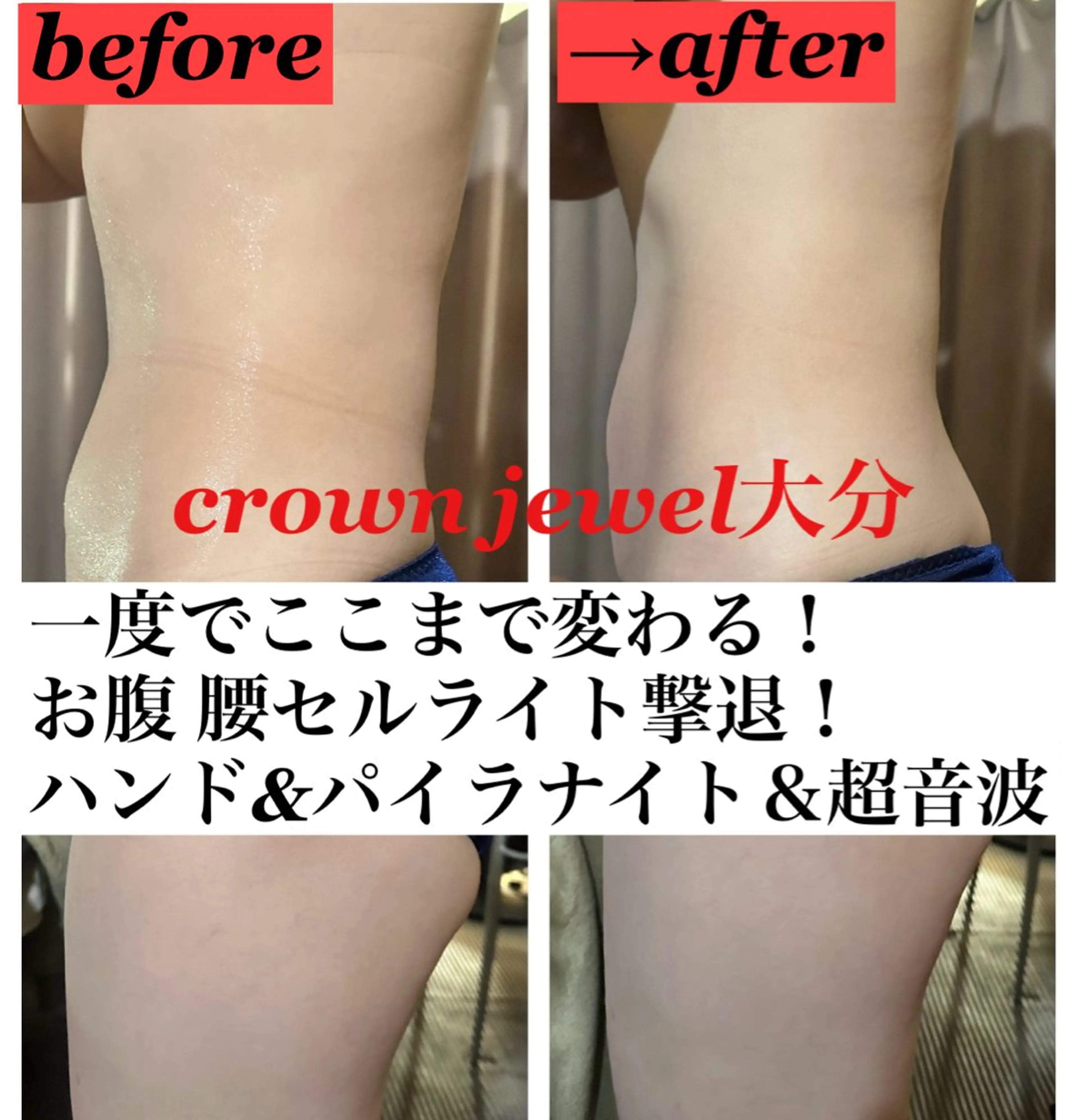 Crown  Jewel所属・CrownJewel クラウン ジュエルのエステ・リラクイメージ