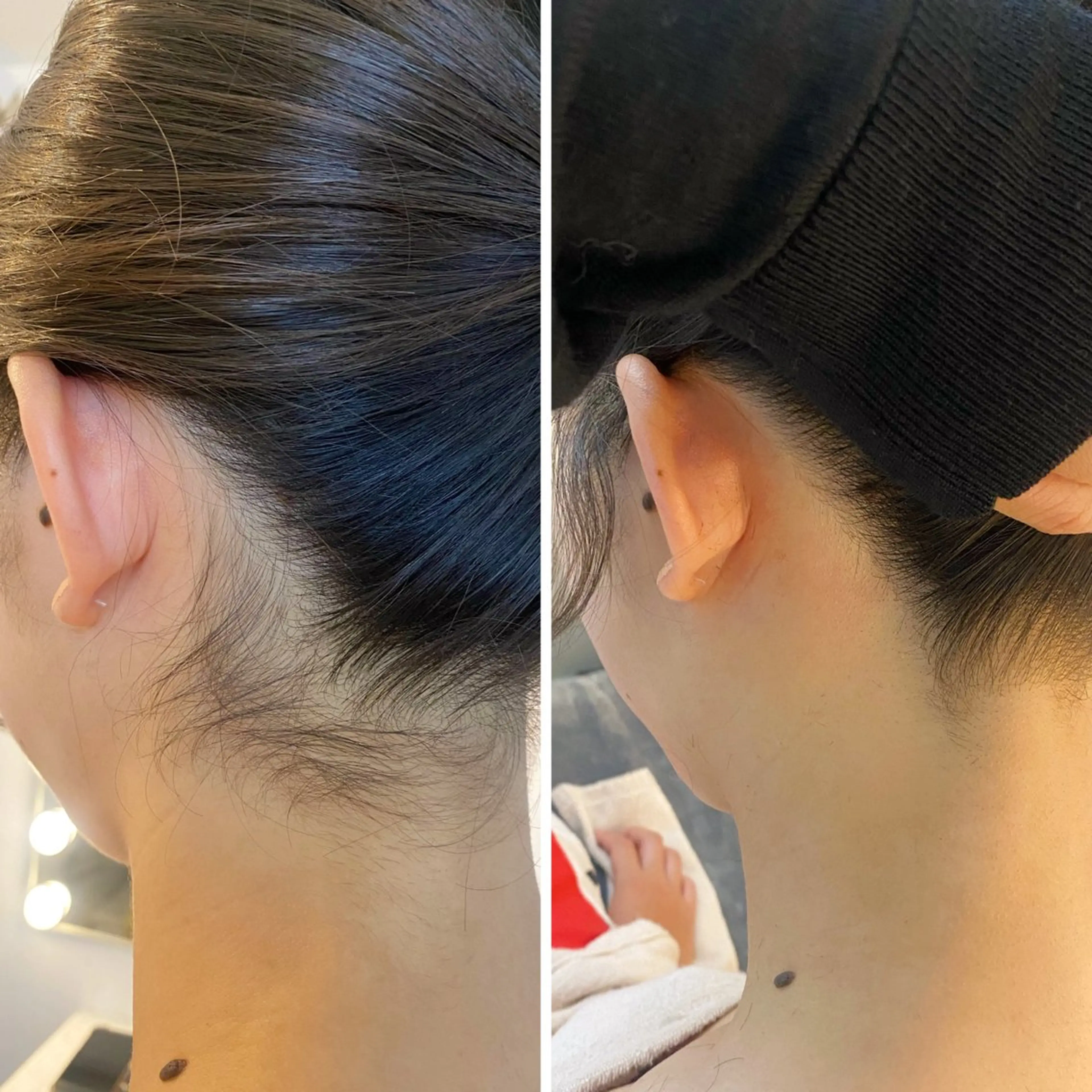 脱毛 うなじ脱毛/美肌脱毛 LABELのエステ・リラクイメージ