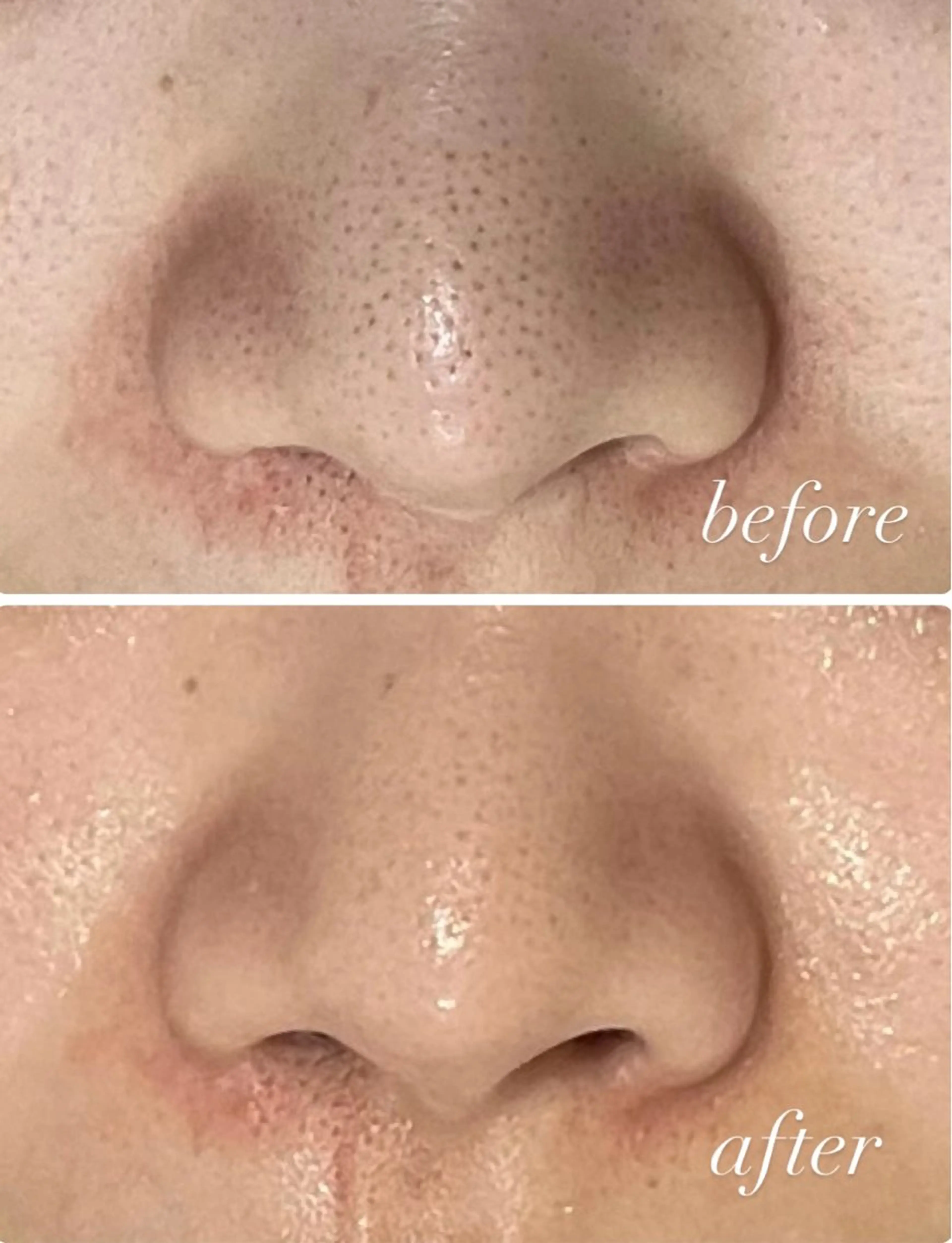 脱毛 RAY Beauty エステ 一宮店のエステ・リラクイメージ