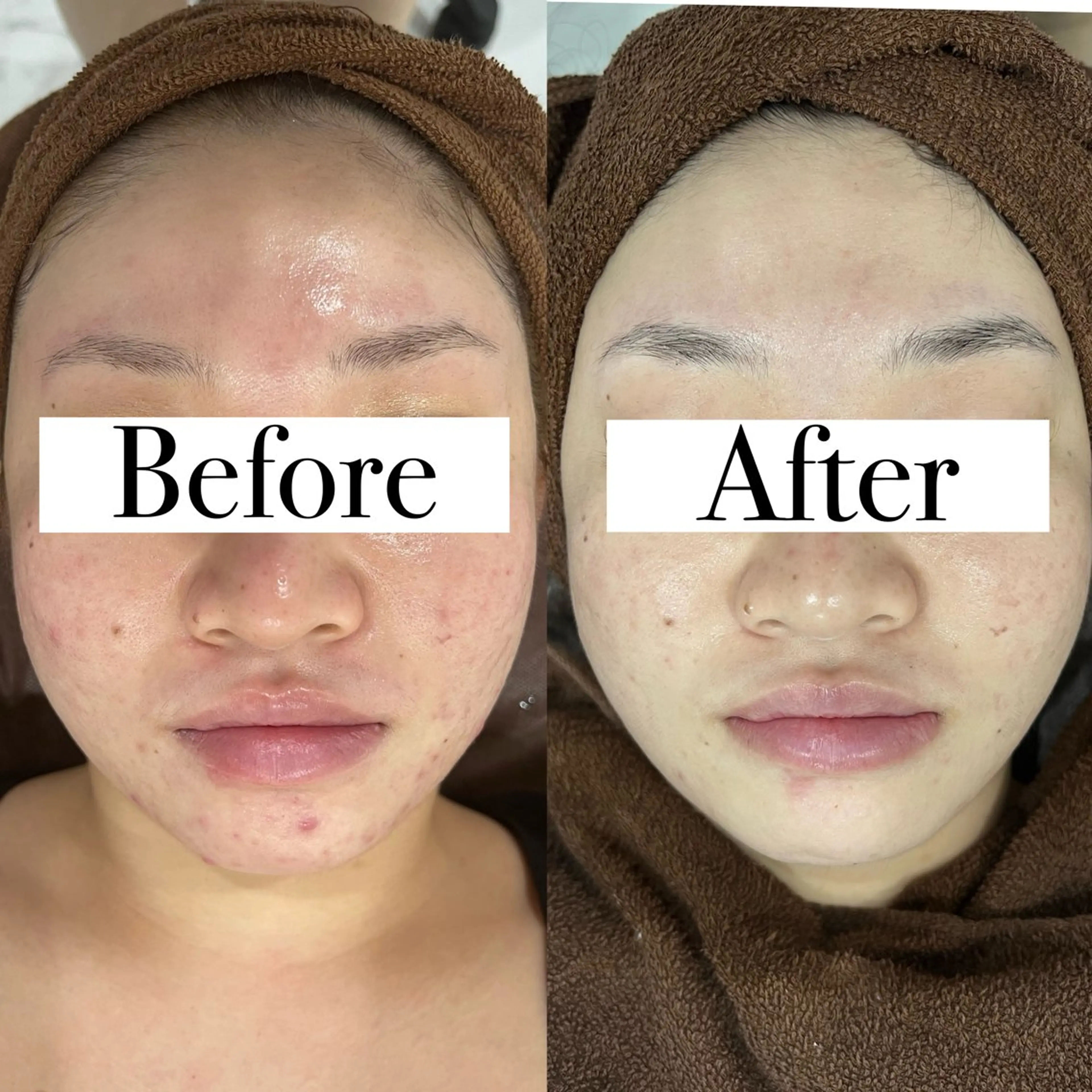 エステ プライベートサロン リプレイスのエステ・リラクイメージ