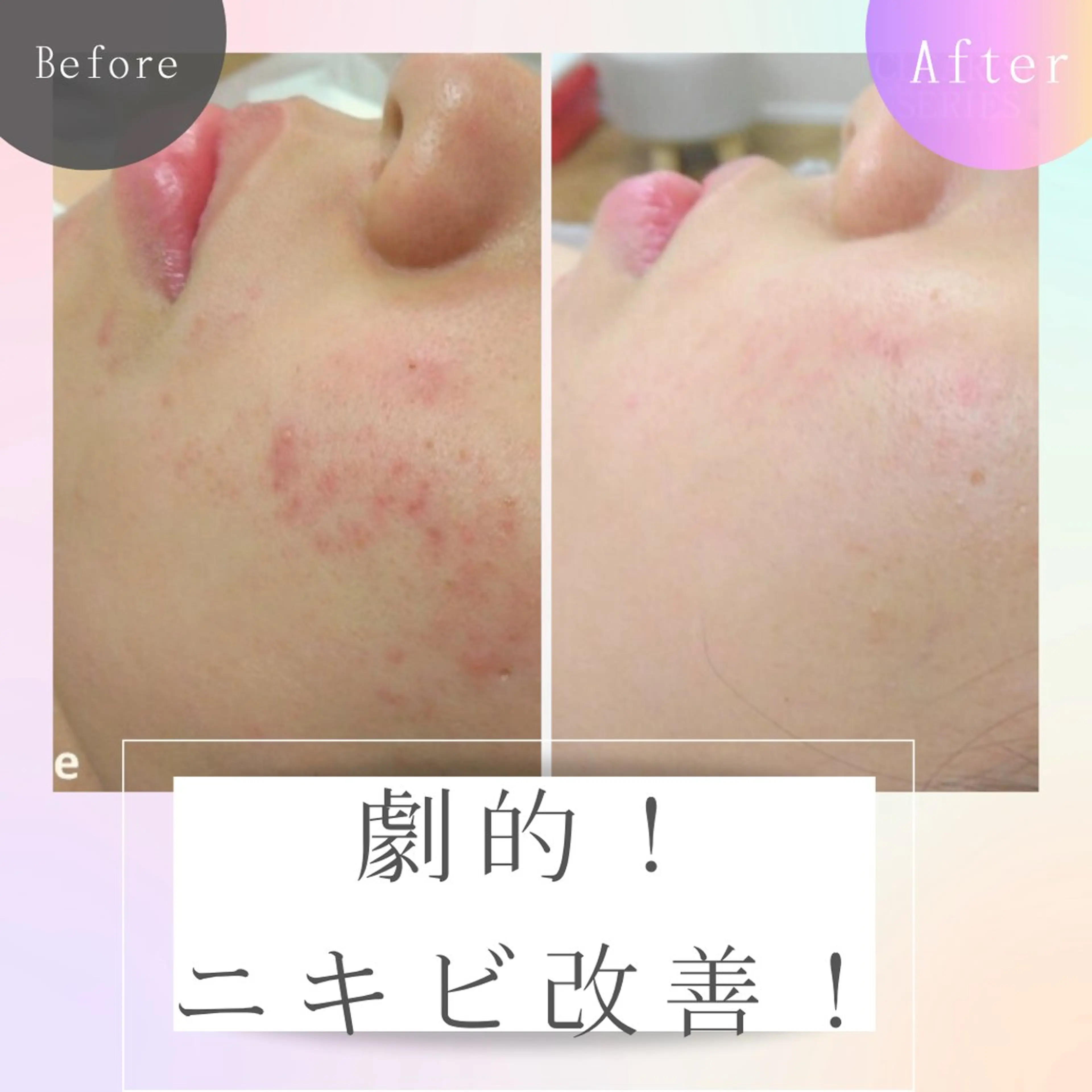 エステ リラク エステサロンさら所属・エステサロン さらのエステ・リラクイメージ