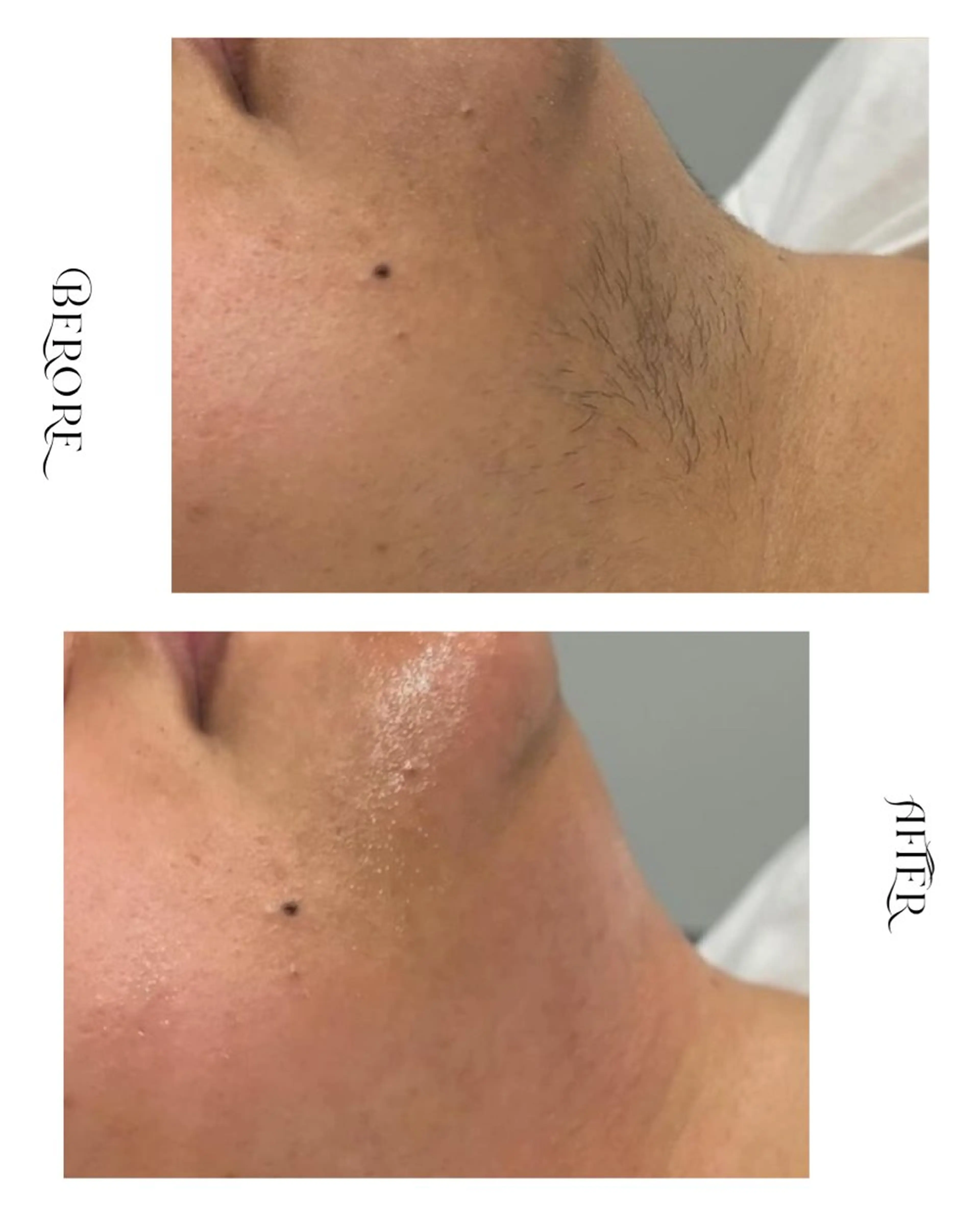 脱毛・肌質改善サロン Linoのエステ・リラクイメージ