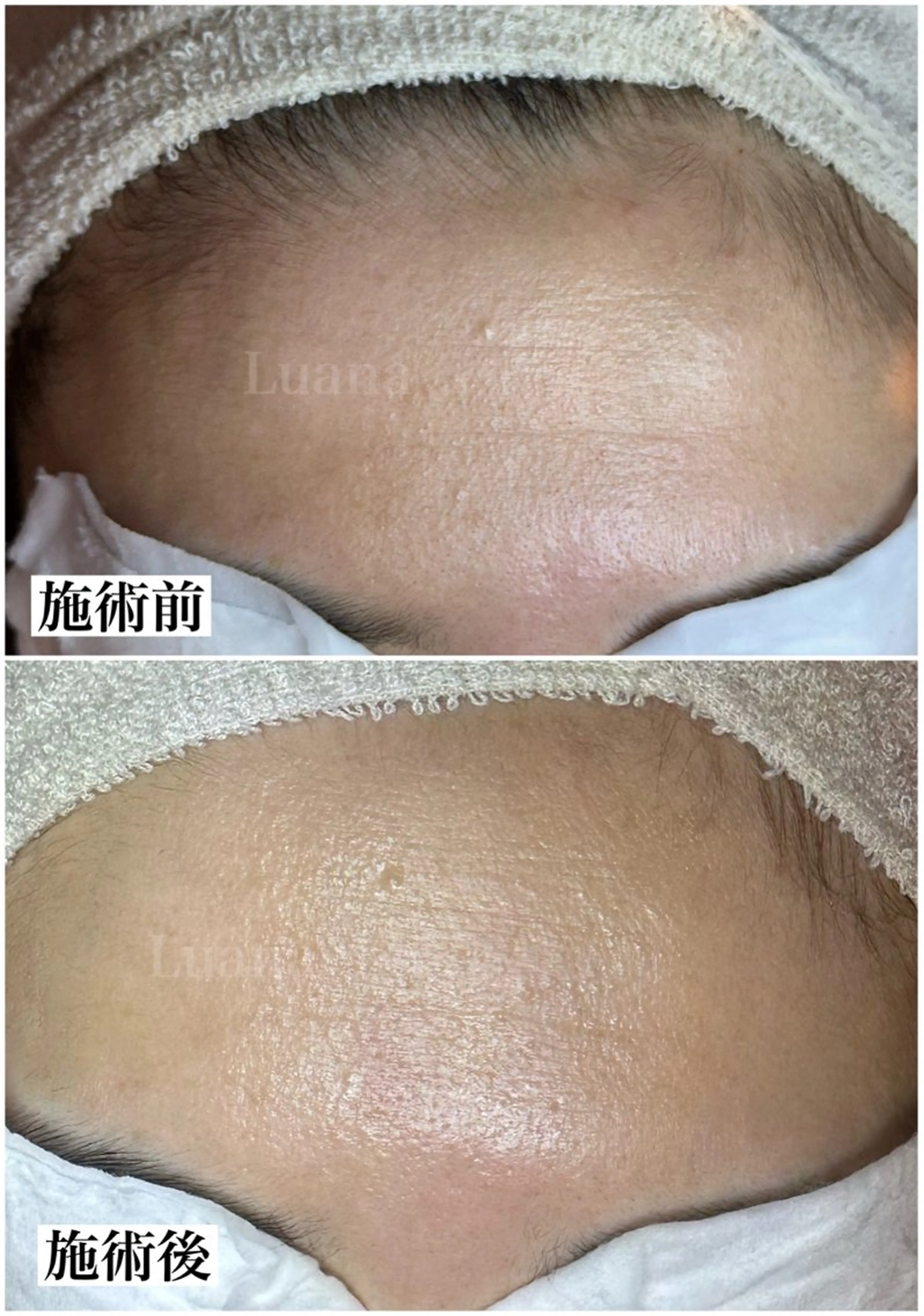 マツヤニWax専門/ 岸和田/Luanaのエステ・リラクイメージ