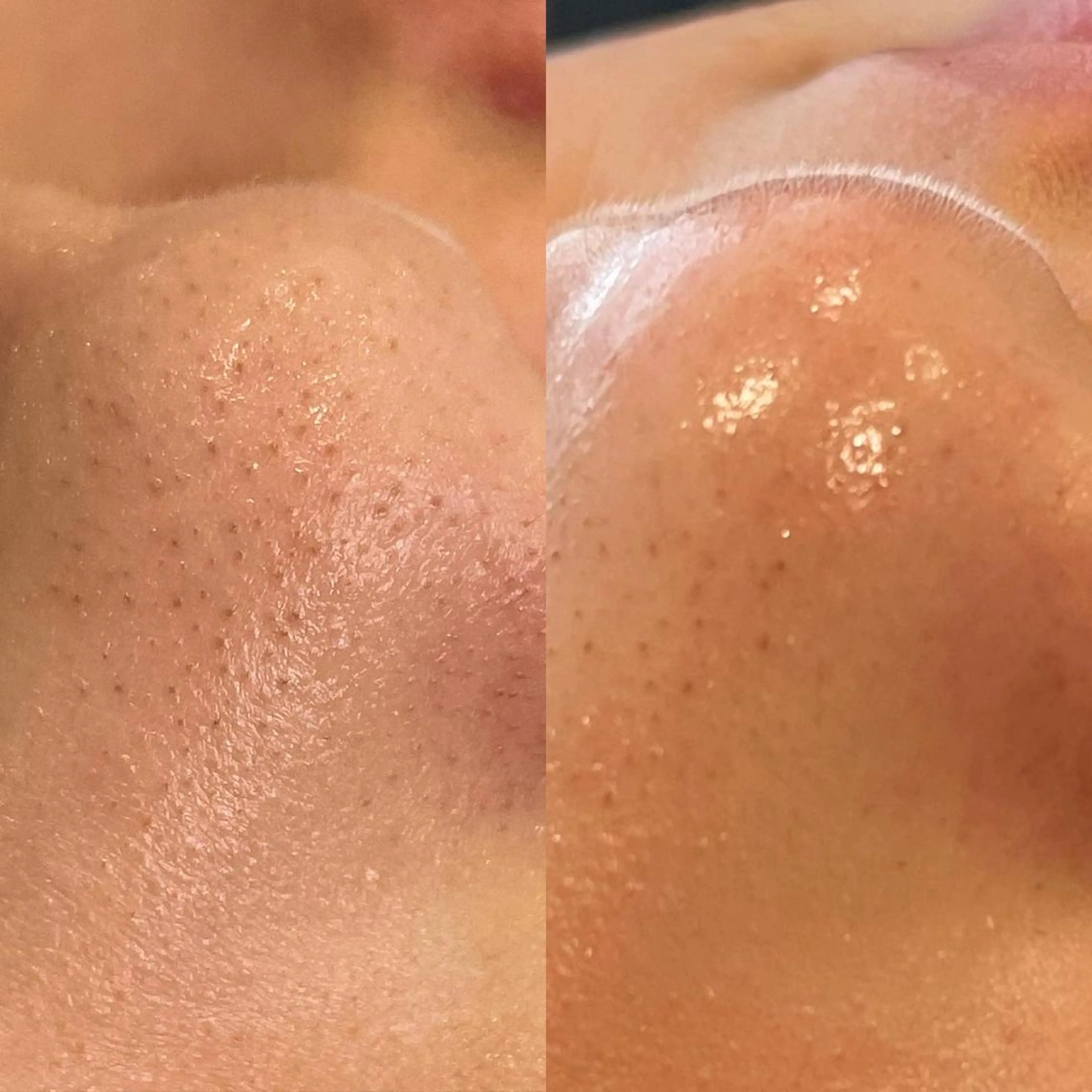 女性のお悩み美容 サロン　ヴィーナスのエステ・リラクイメージ