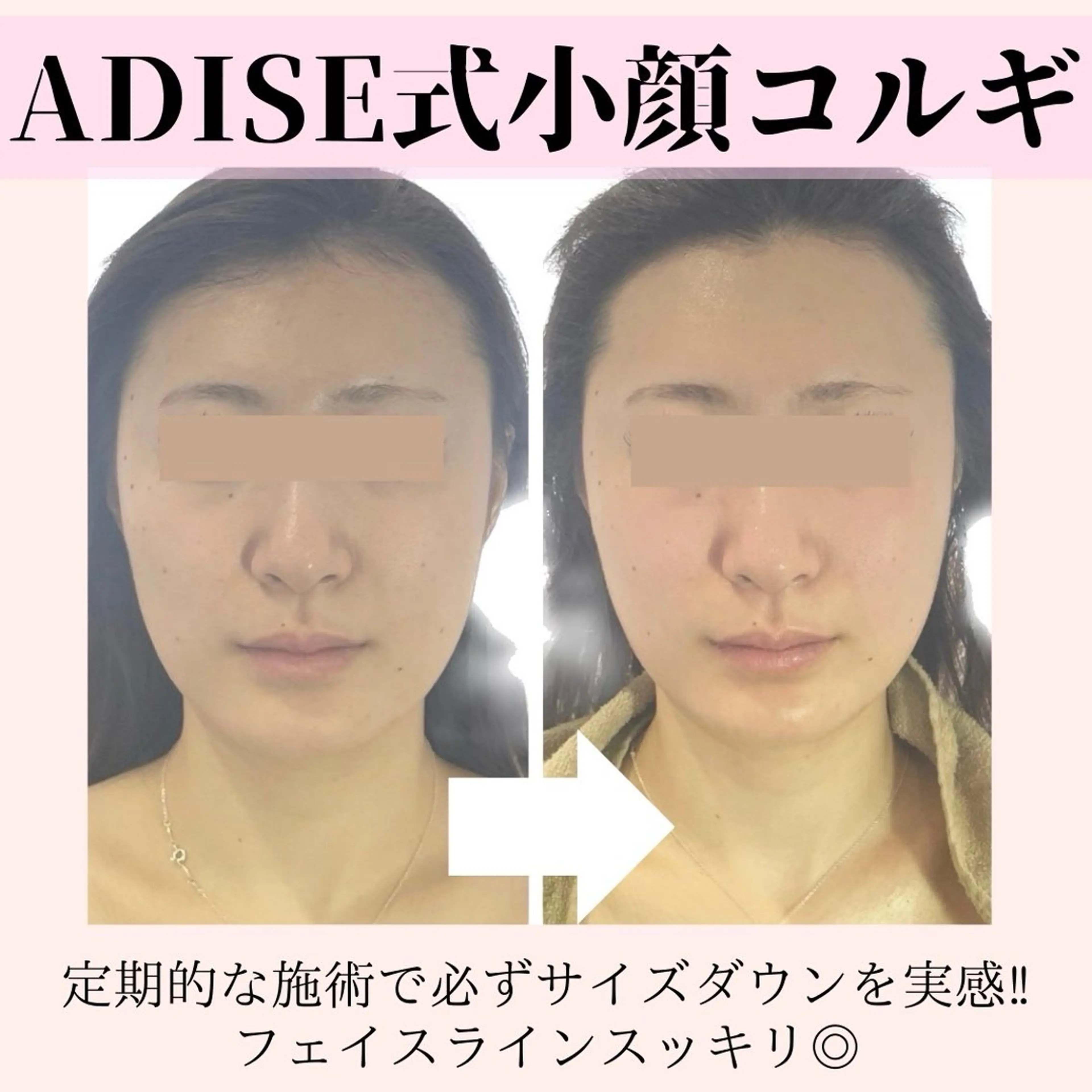 第一印象専門サロン ADISEのエステ・リラクイメージ