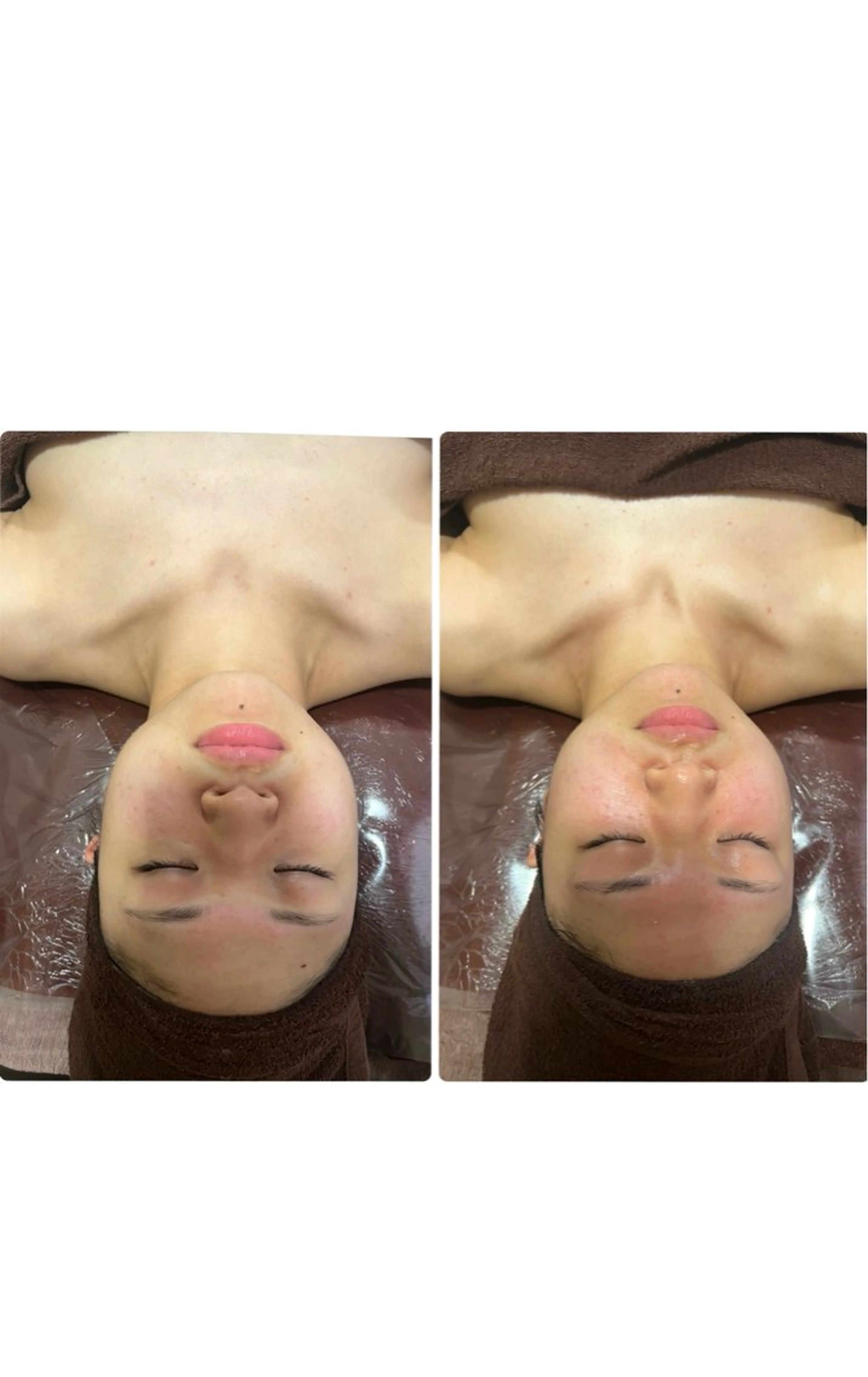 espresso,所属・《痩身、小顔専門店》 エスプレッソのエステ・リラクイメージ